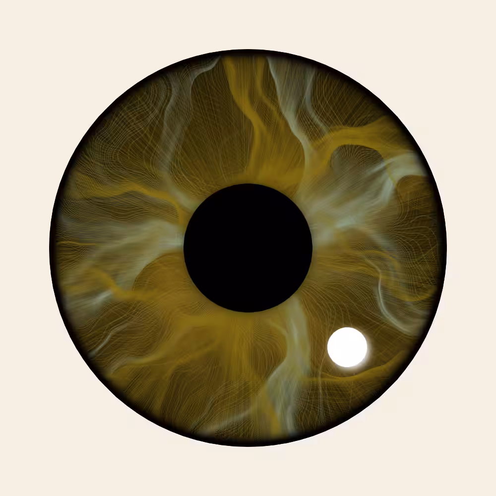 Iris Diffusion #10