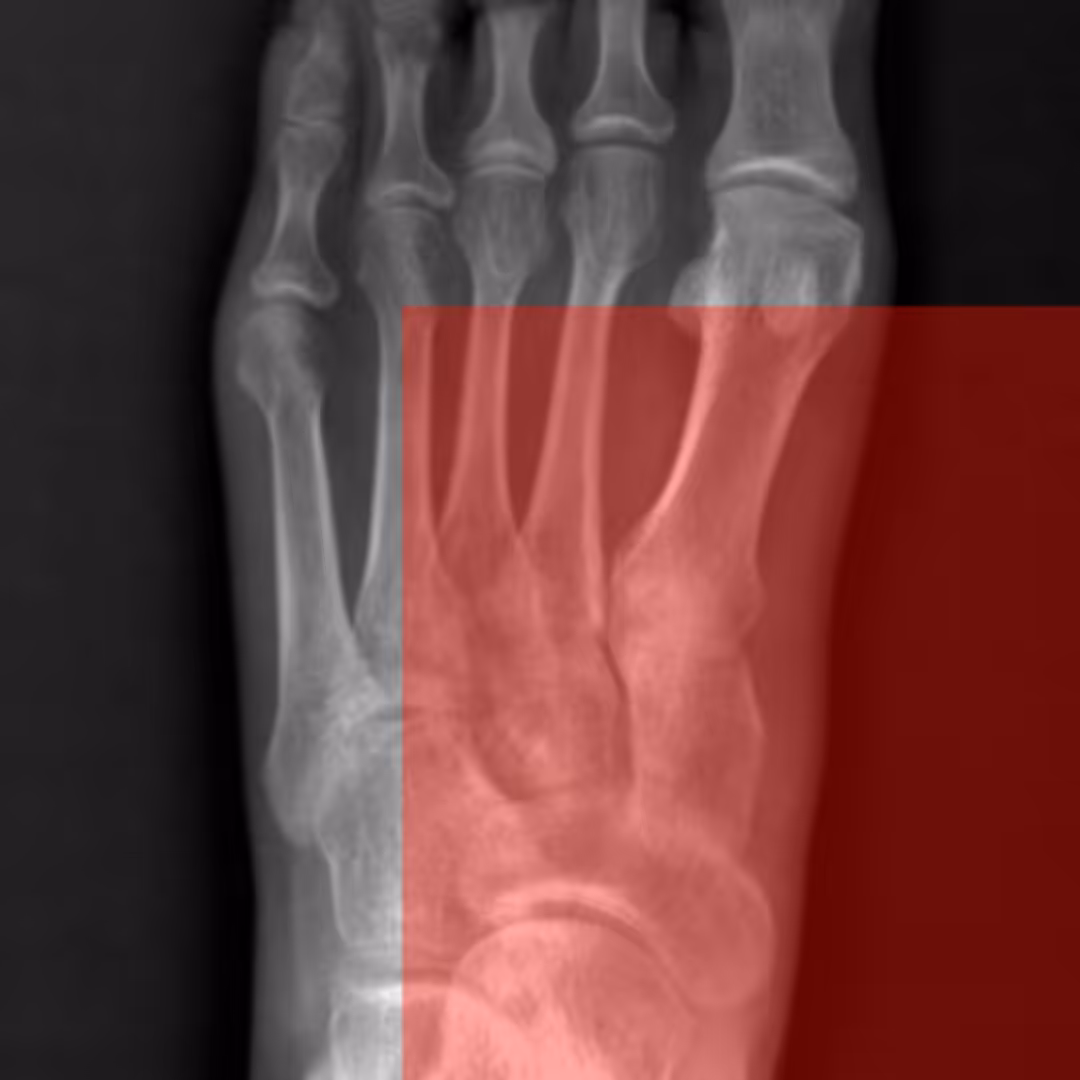 X-Ray_03