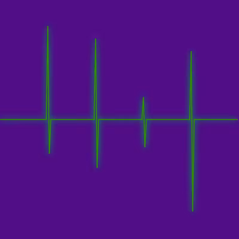 Heart Beat #4