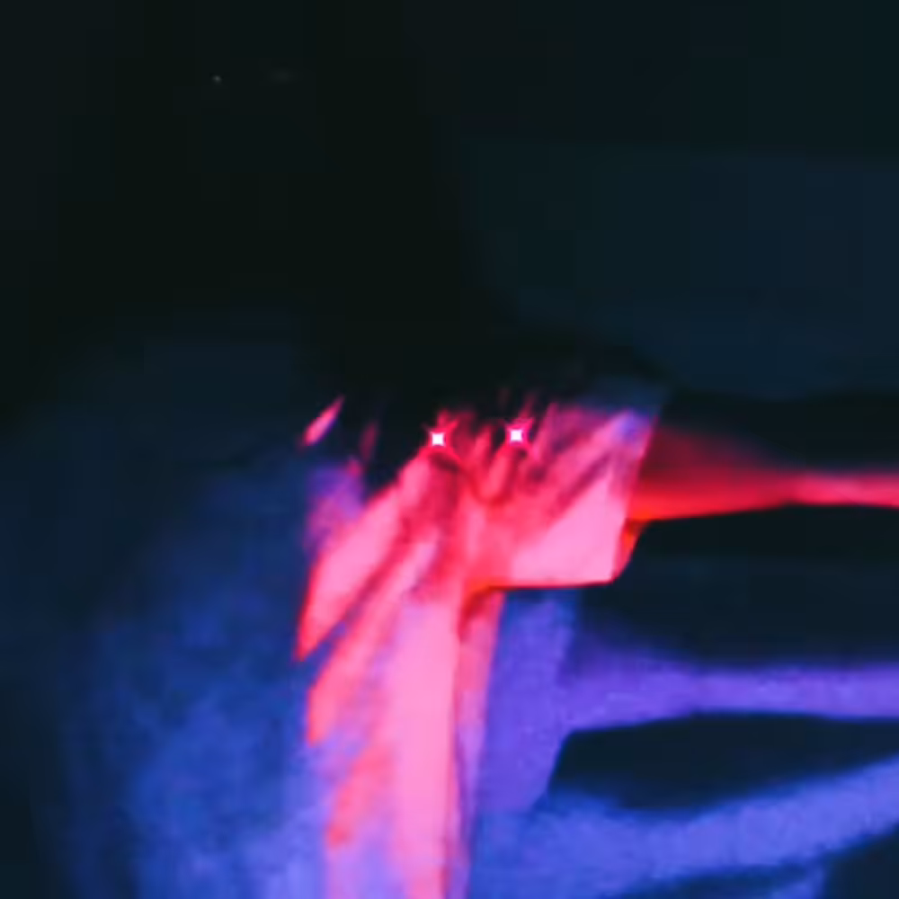 GLITTERING