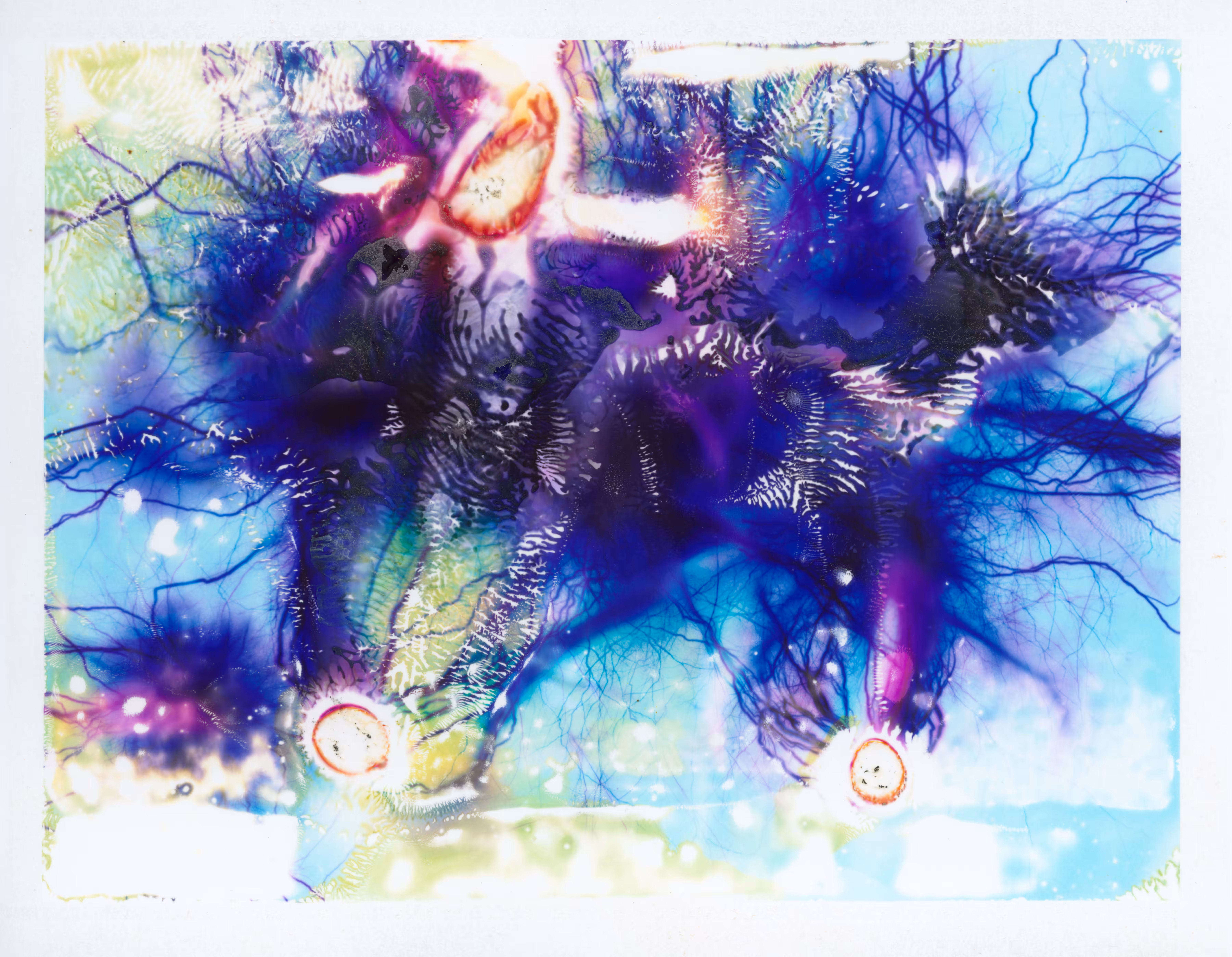 High Voltage Images: Retinal Pigment Epithelium 7