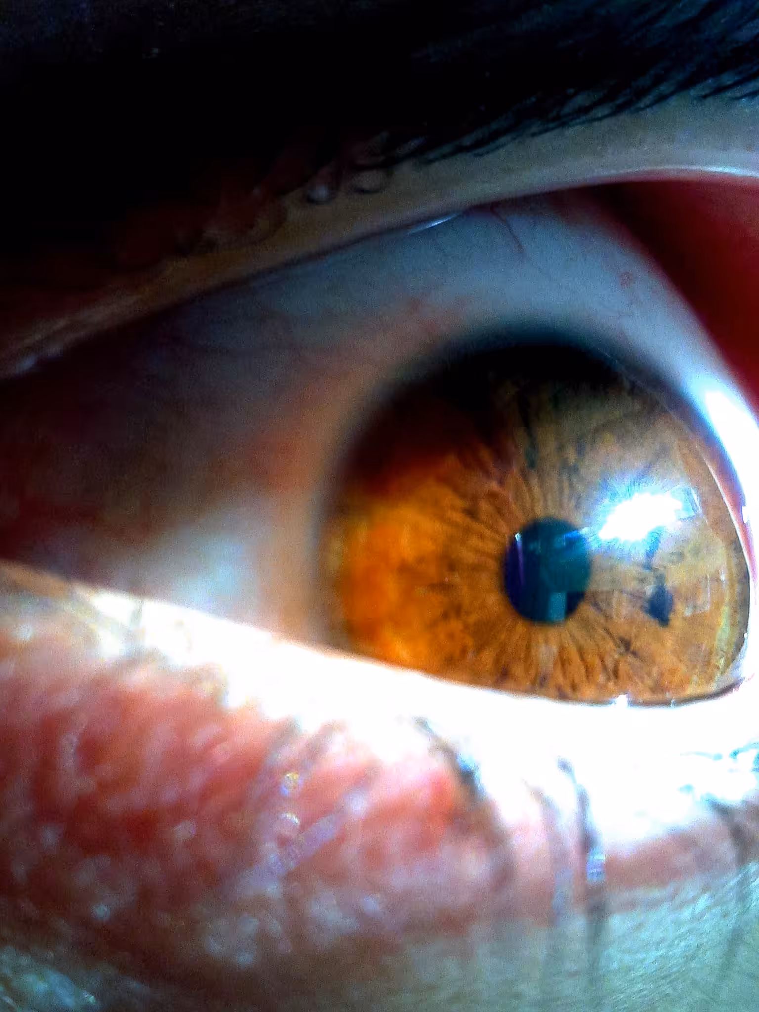 Meat Lens