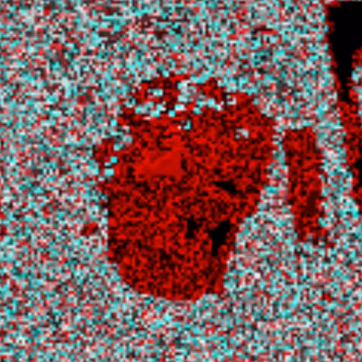 Medula