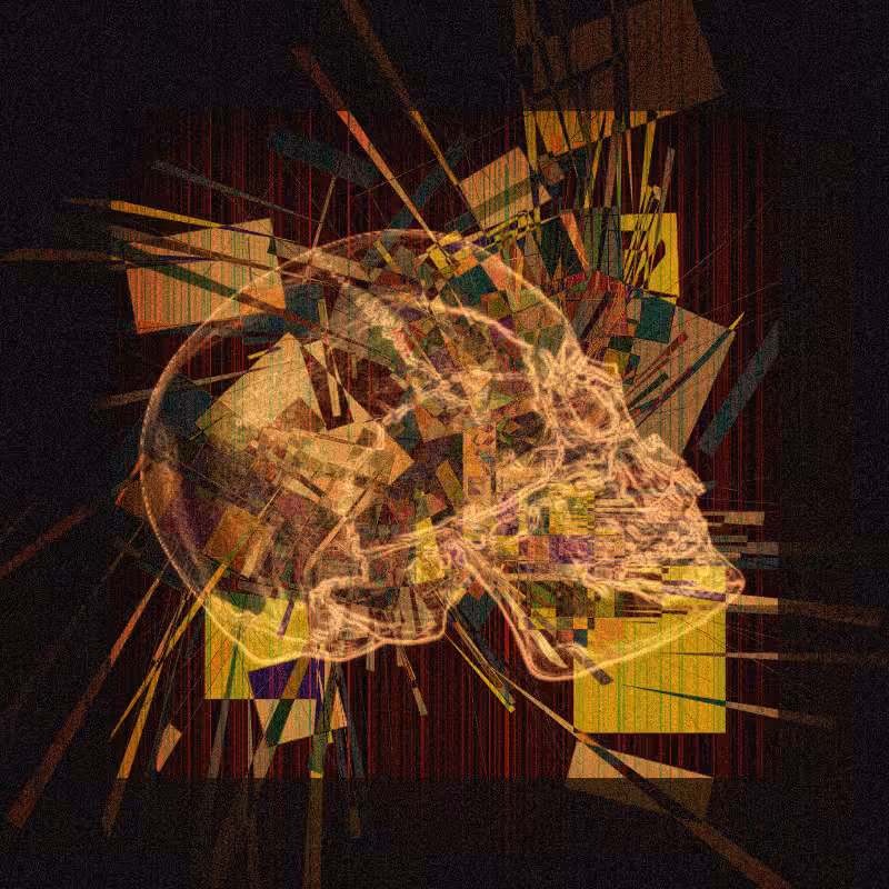 X-ray of a skull #15