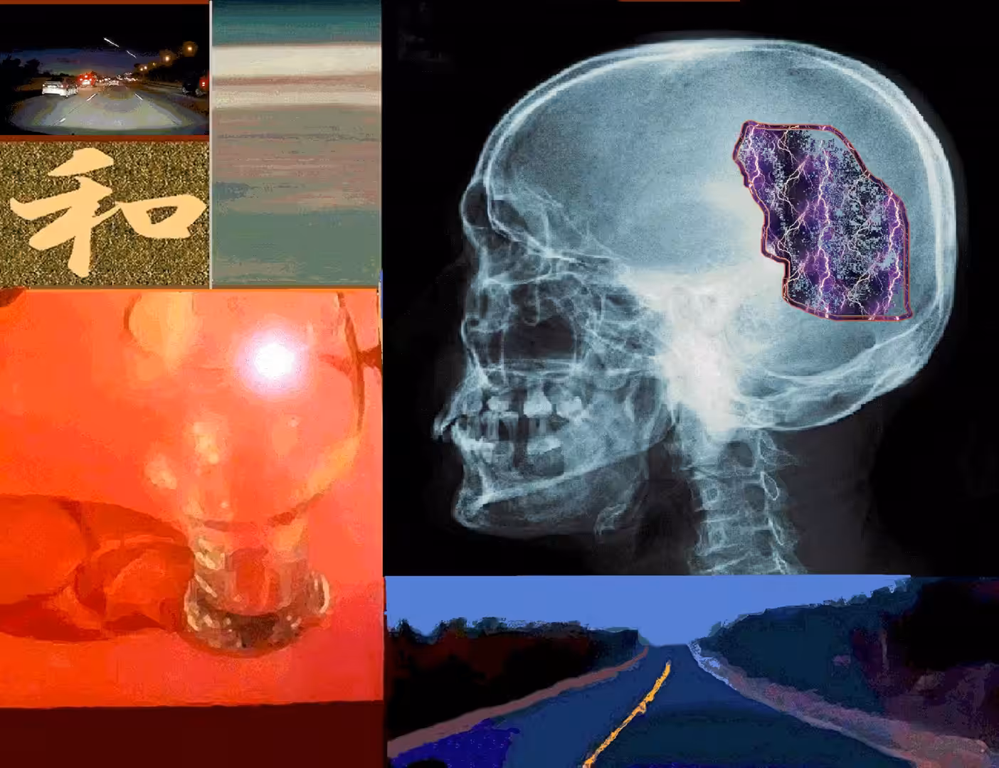 Concussion on Hwy. 599