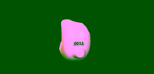 FNTN // 32