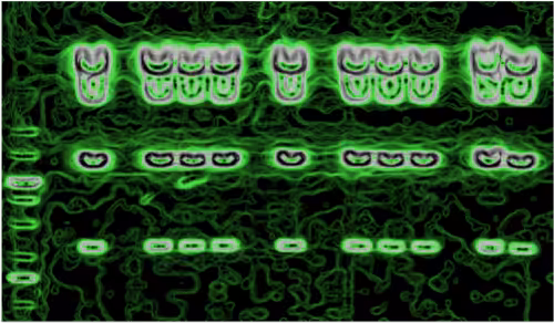 The Final Gel #04