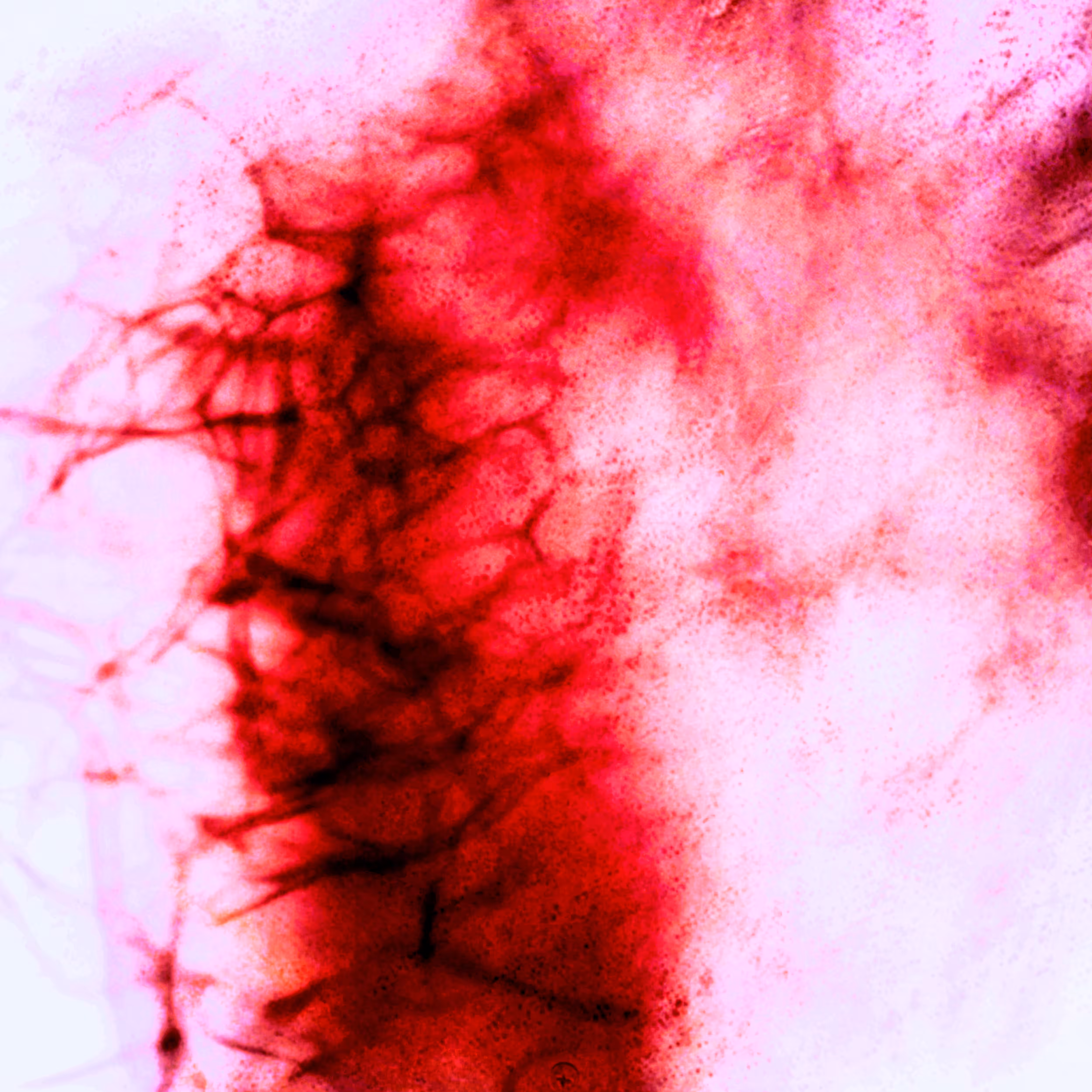 BrainDead #05