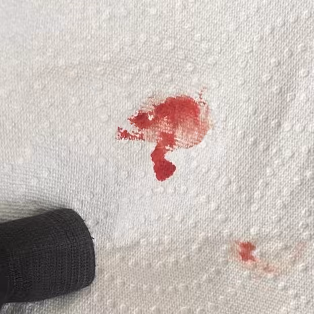 Lip