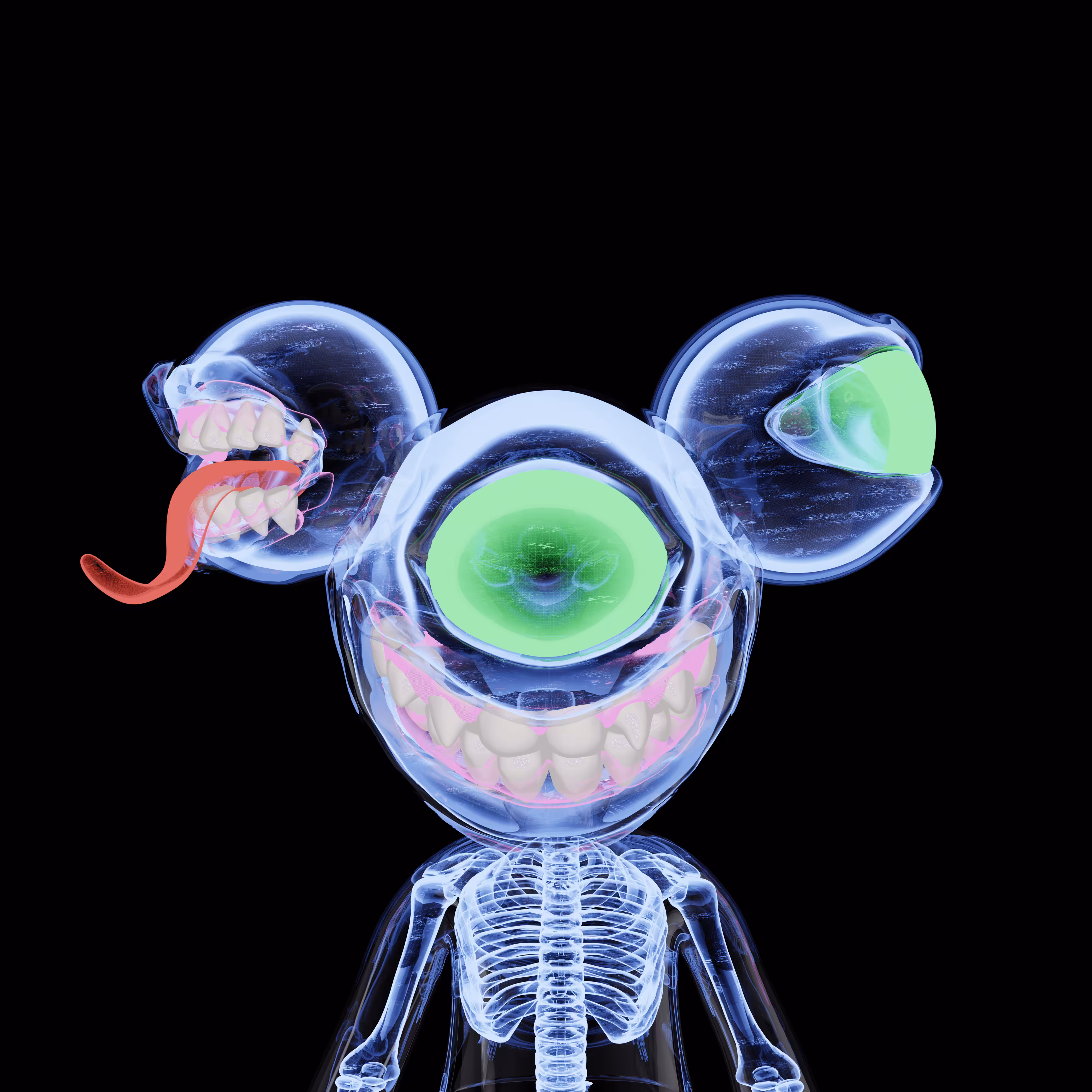 X-Ray