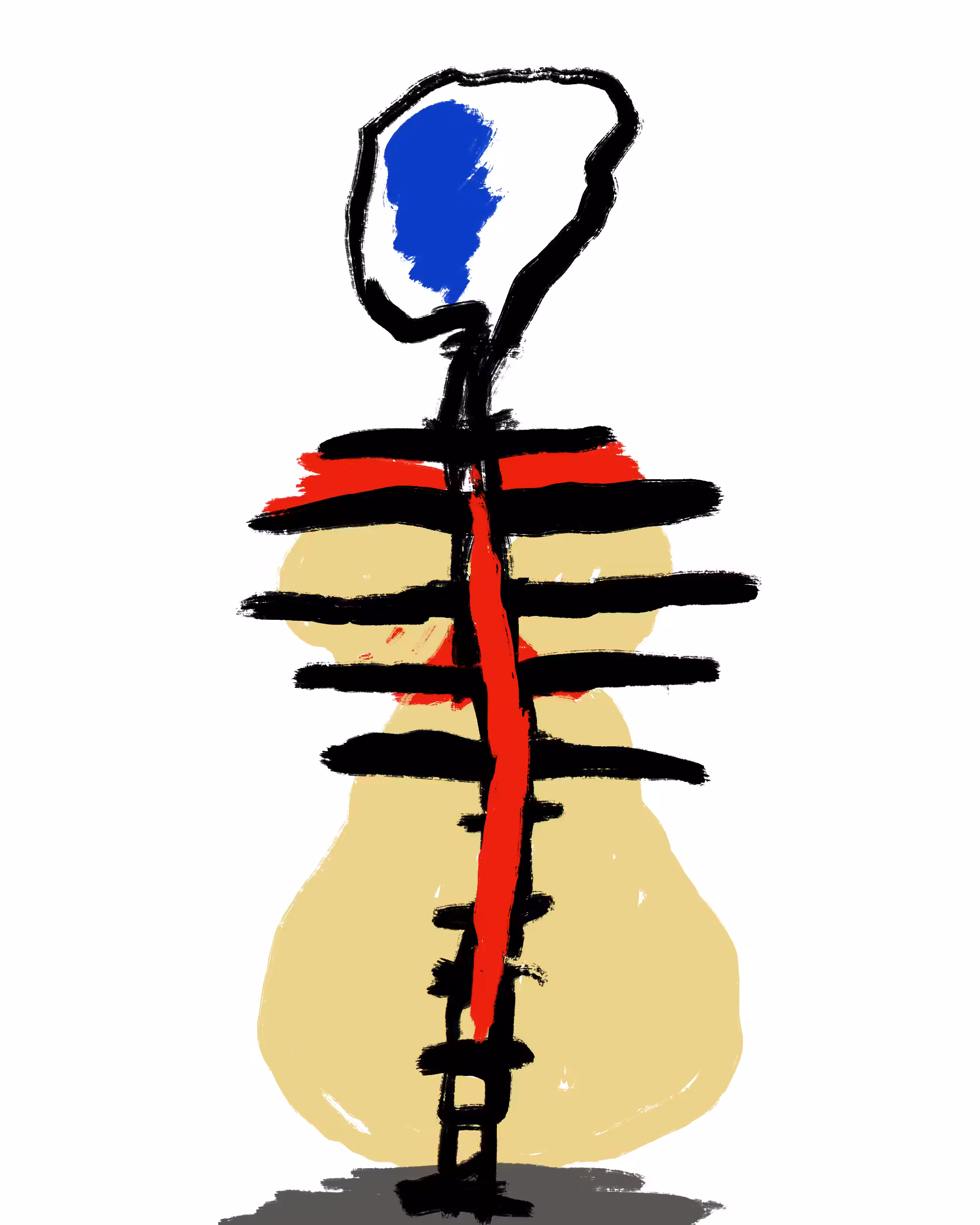 Starting bone pain #2