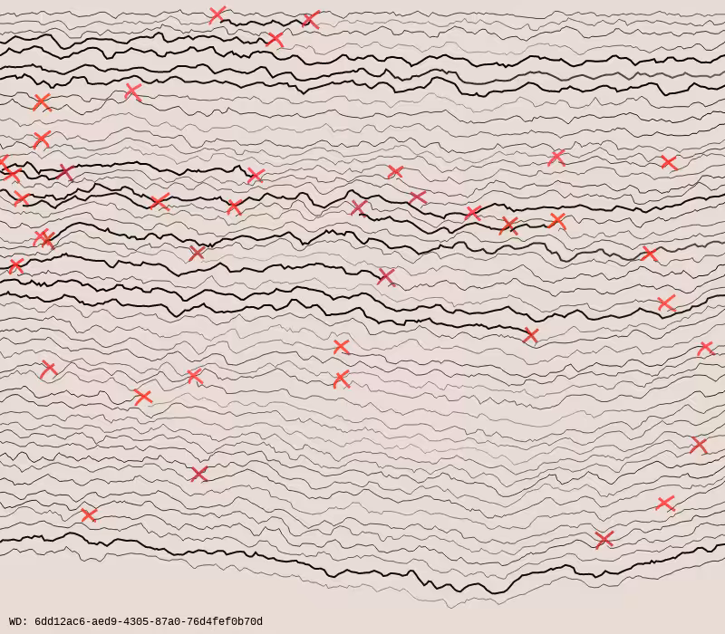 Wall Drawing #31