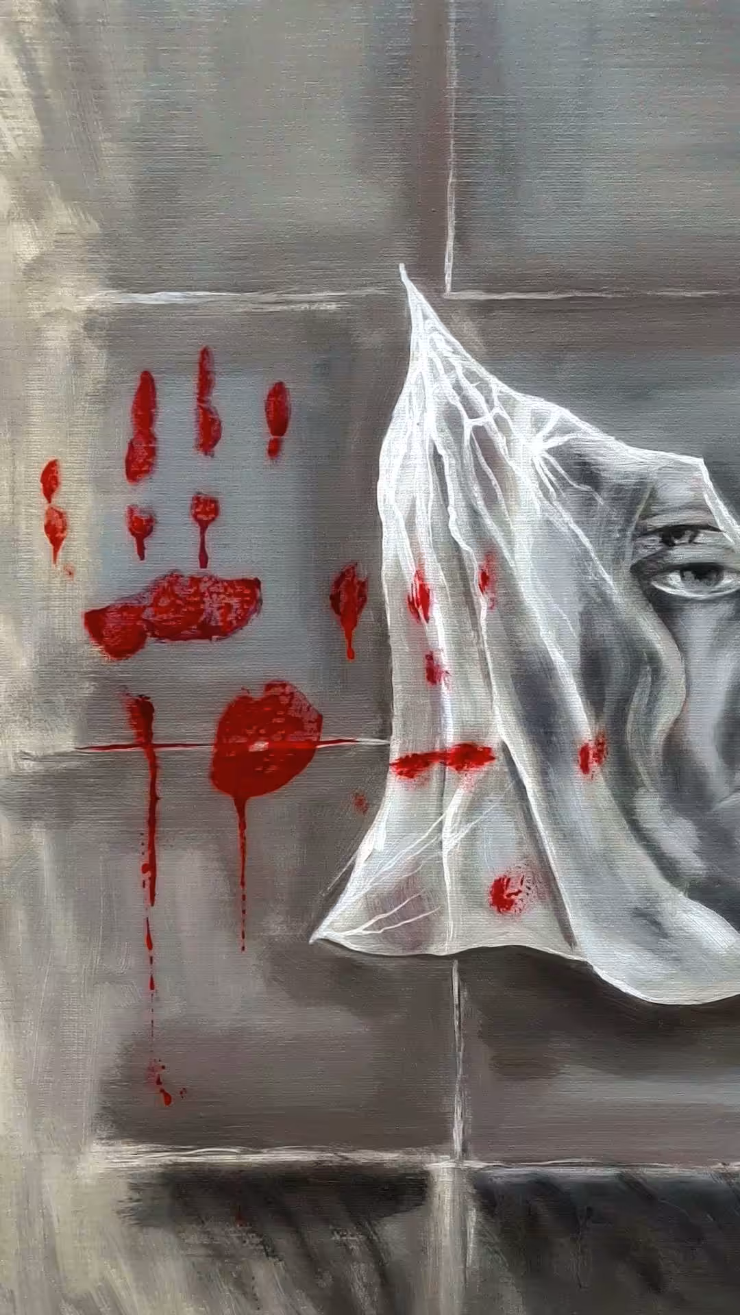Schizophrenia.