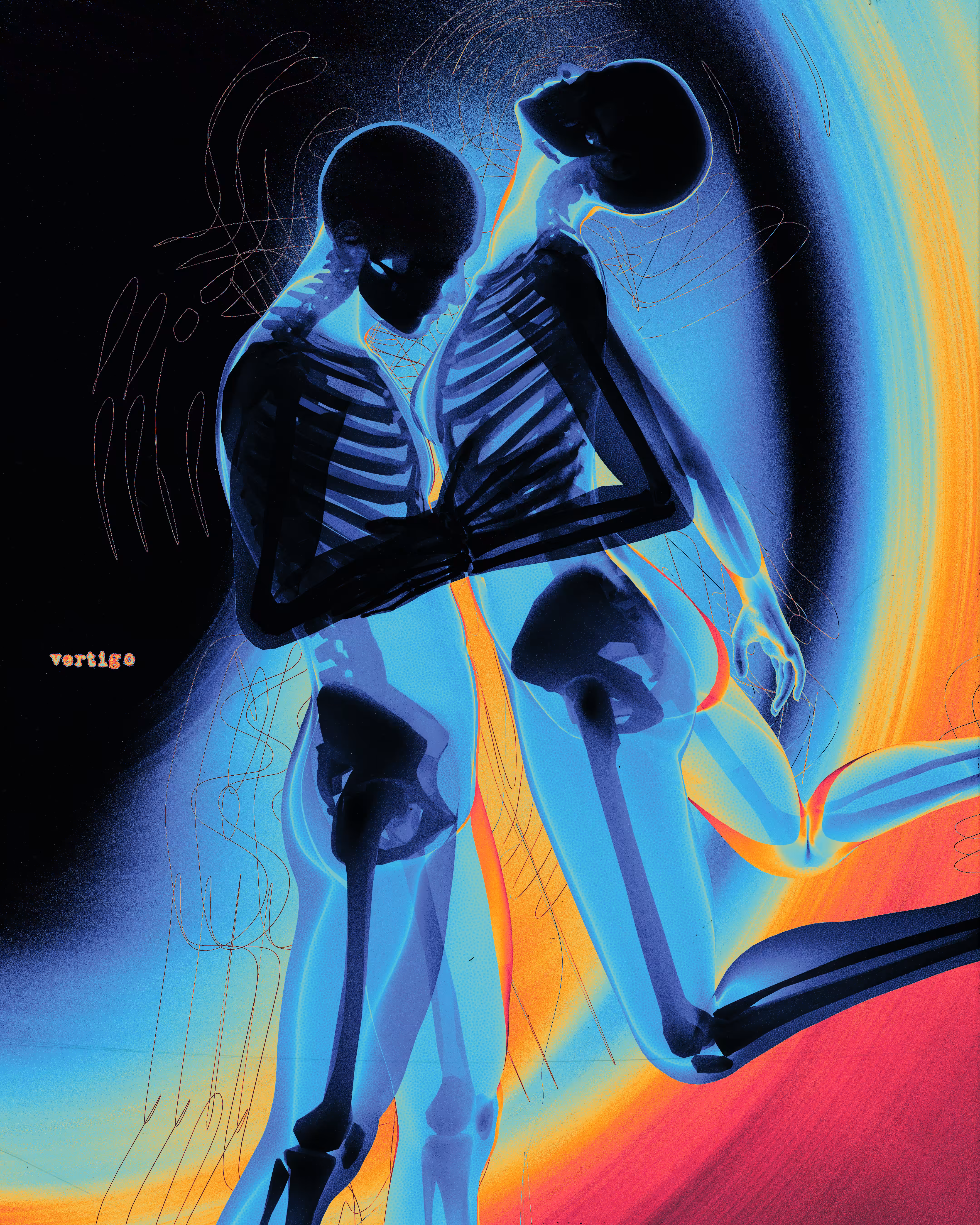 Vertigo