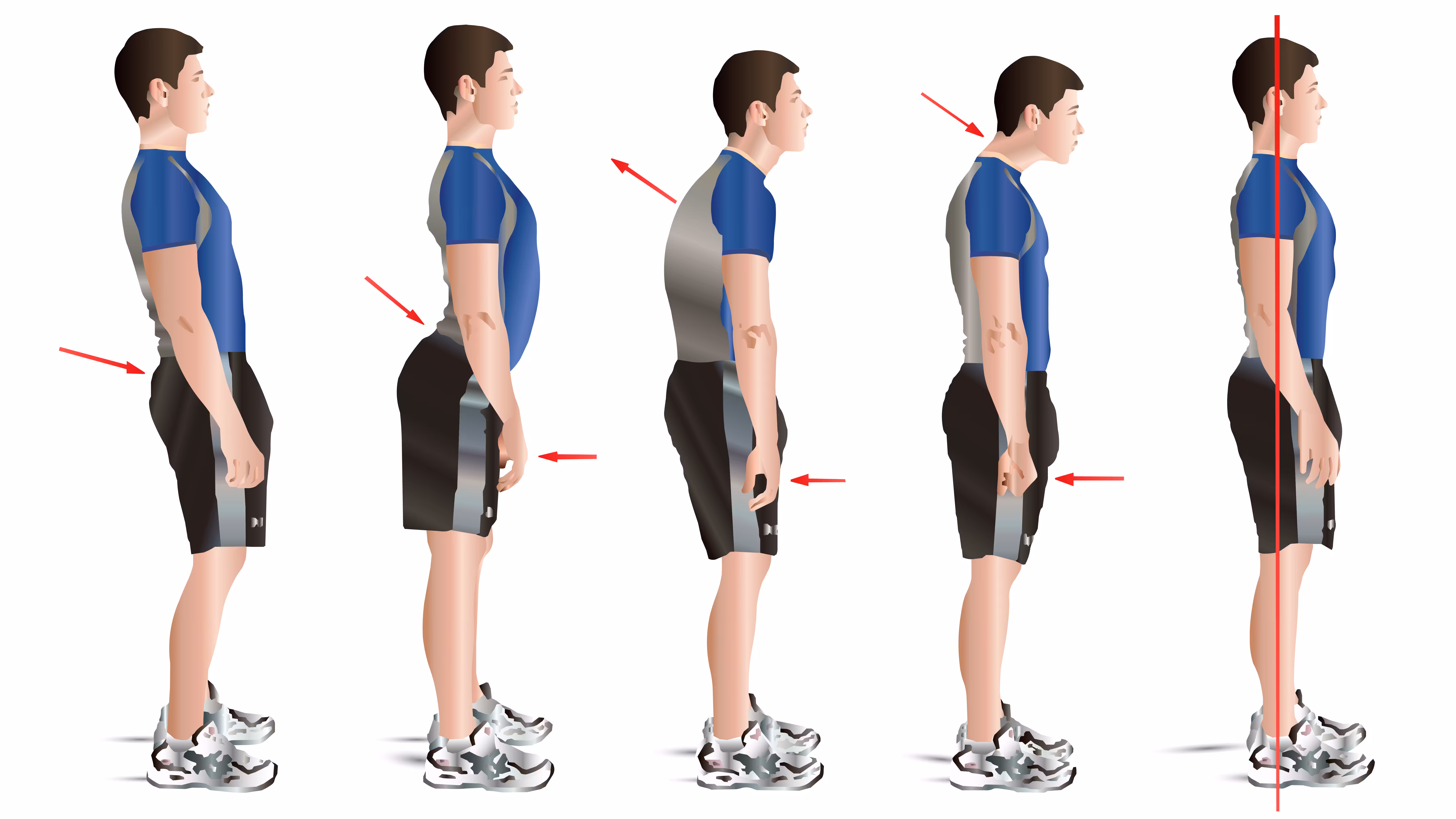 Not dictated: Good posture