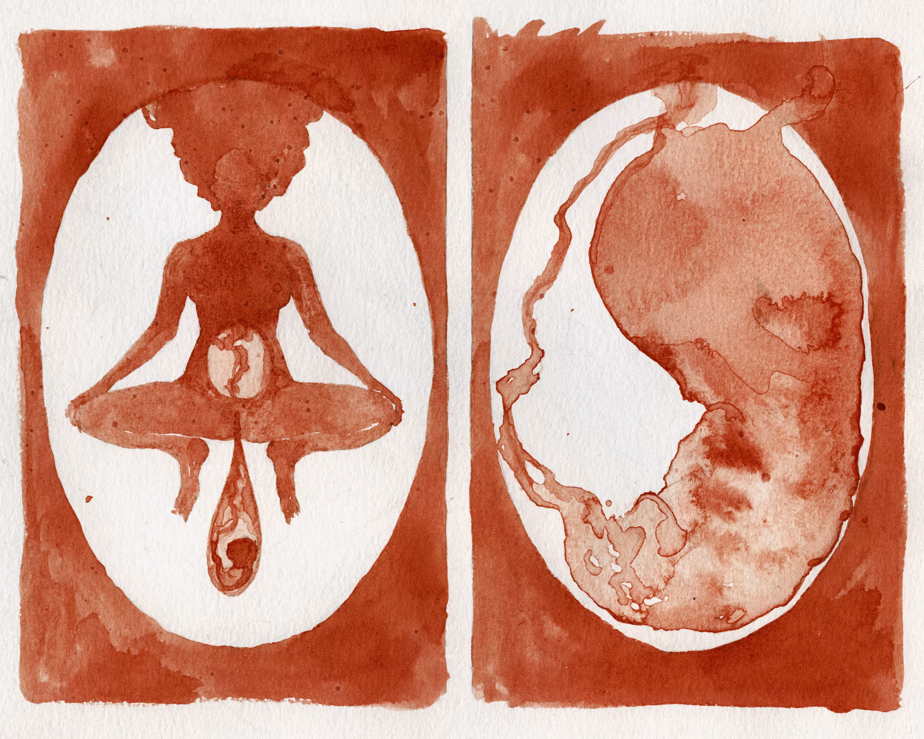 afterbirth