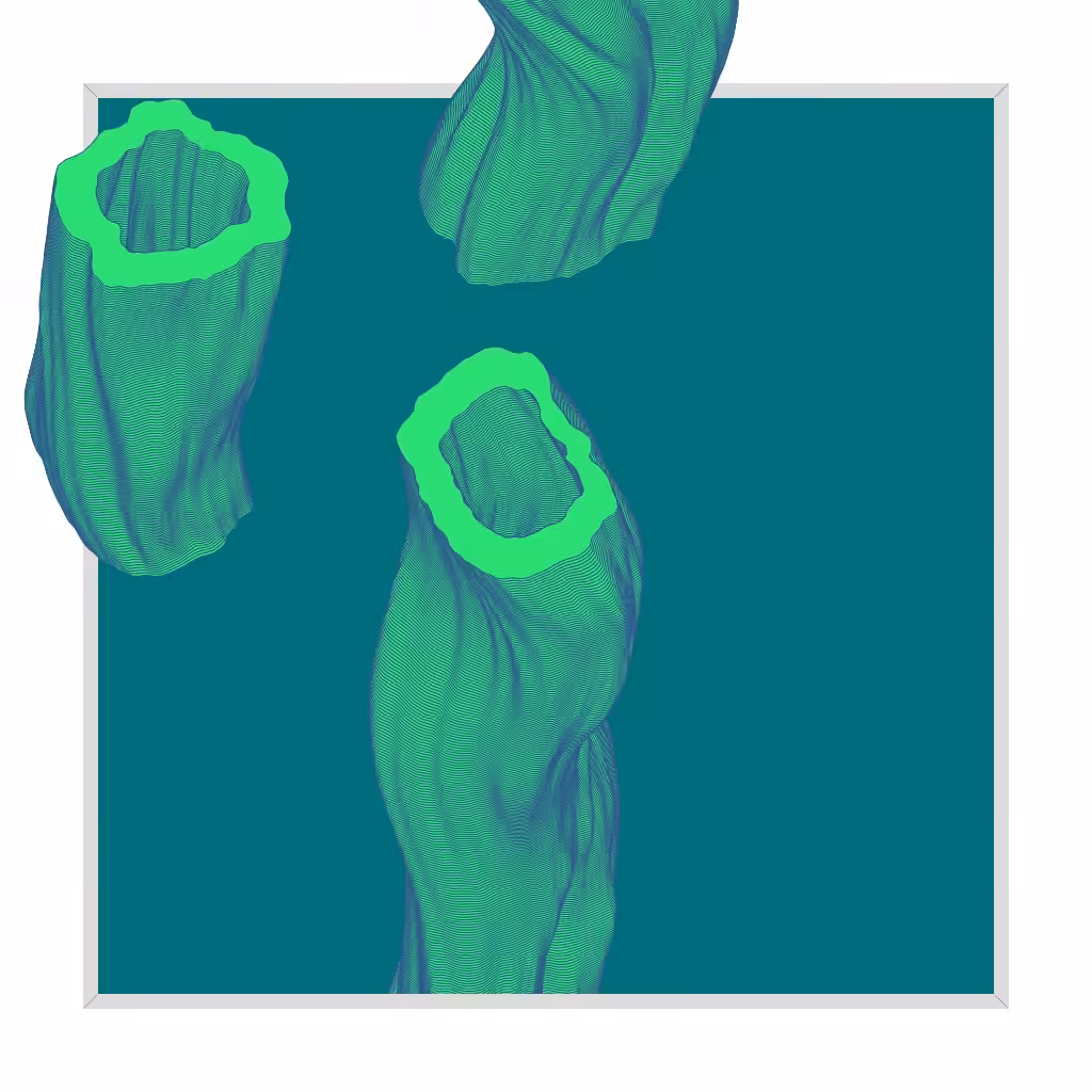 Framed Growth 106