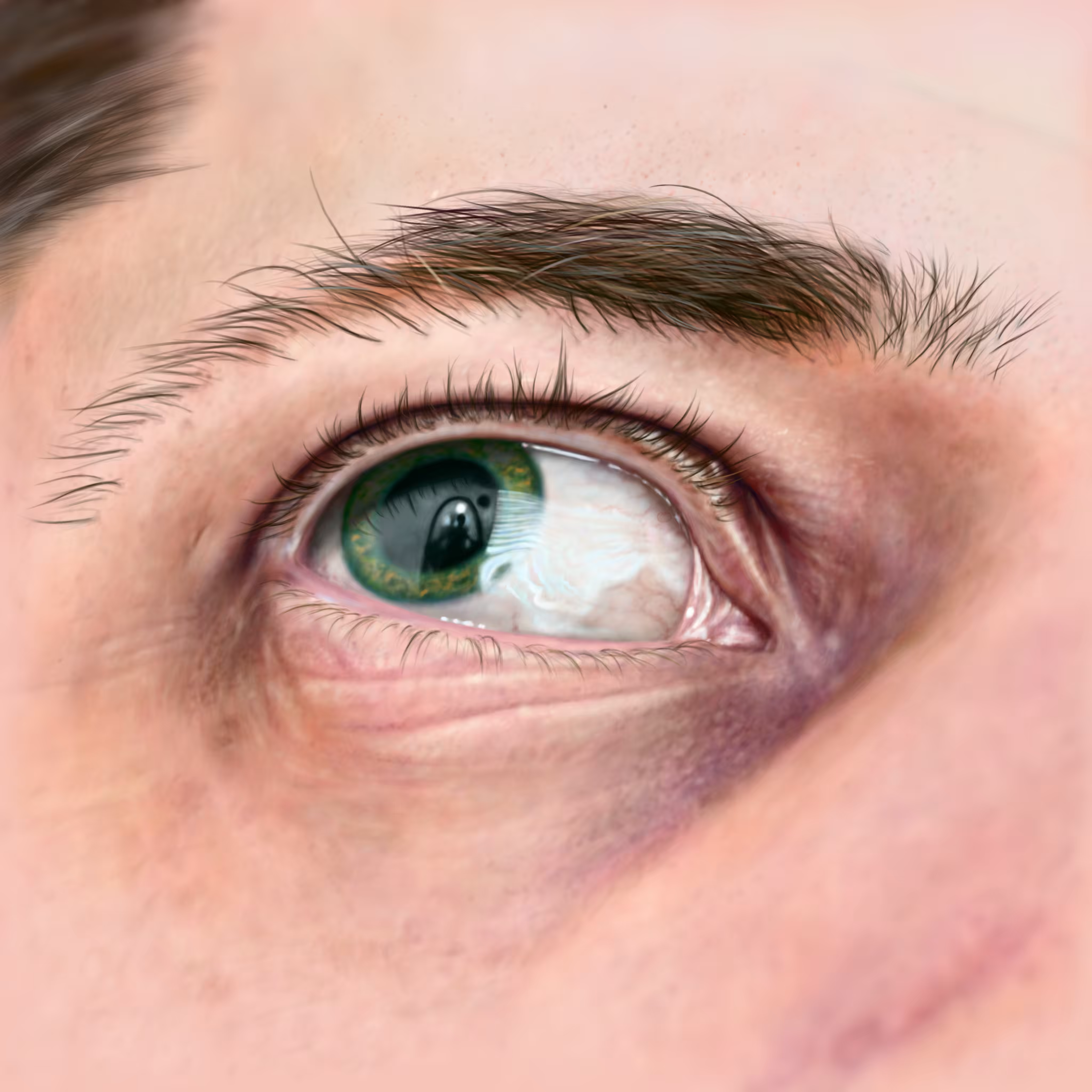 Eye See You
