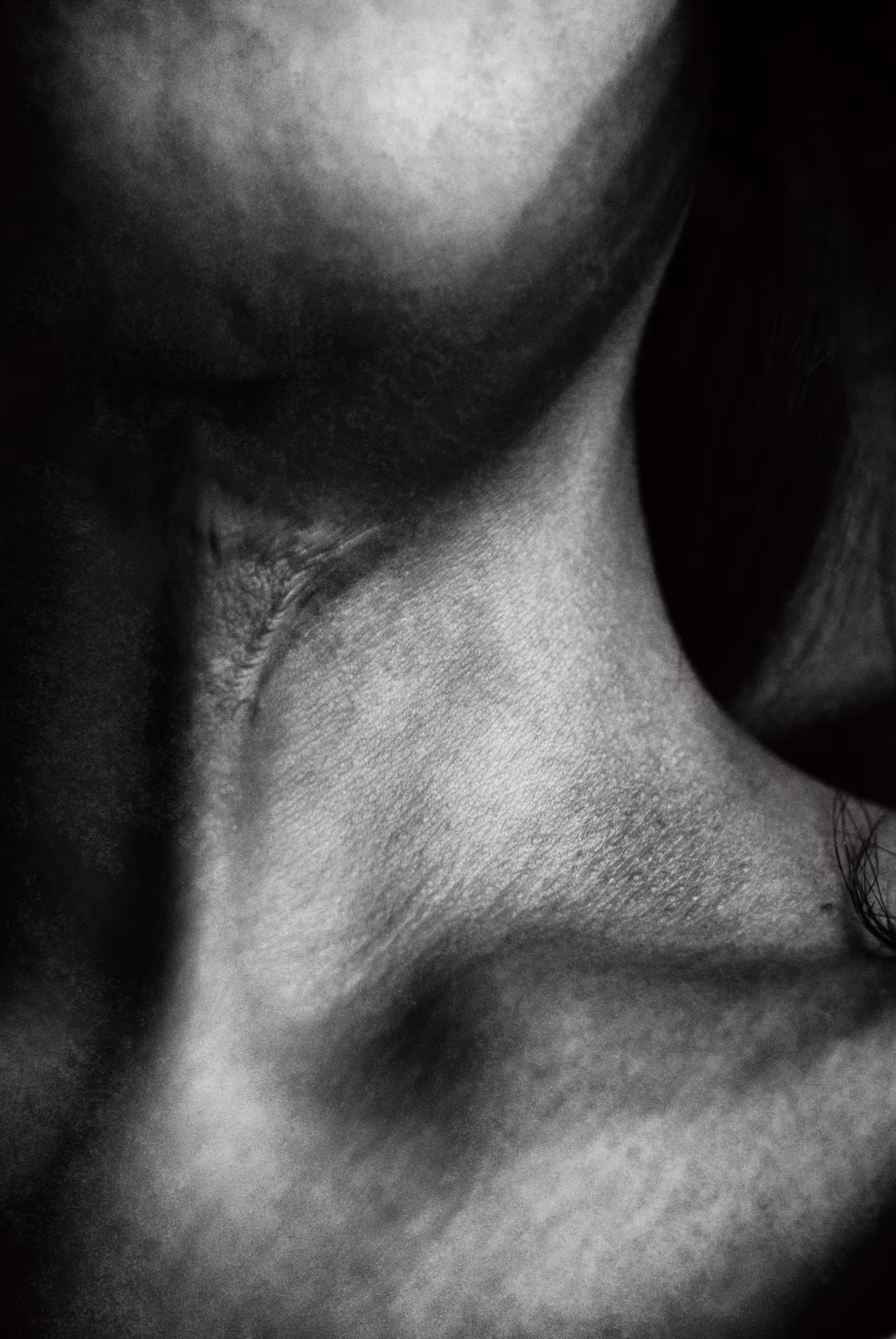 On My Skin