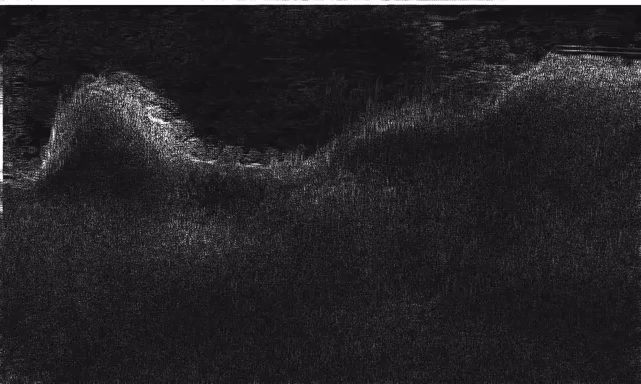 Topography of Noise – I