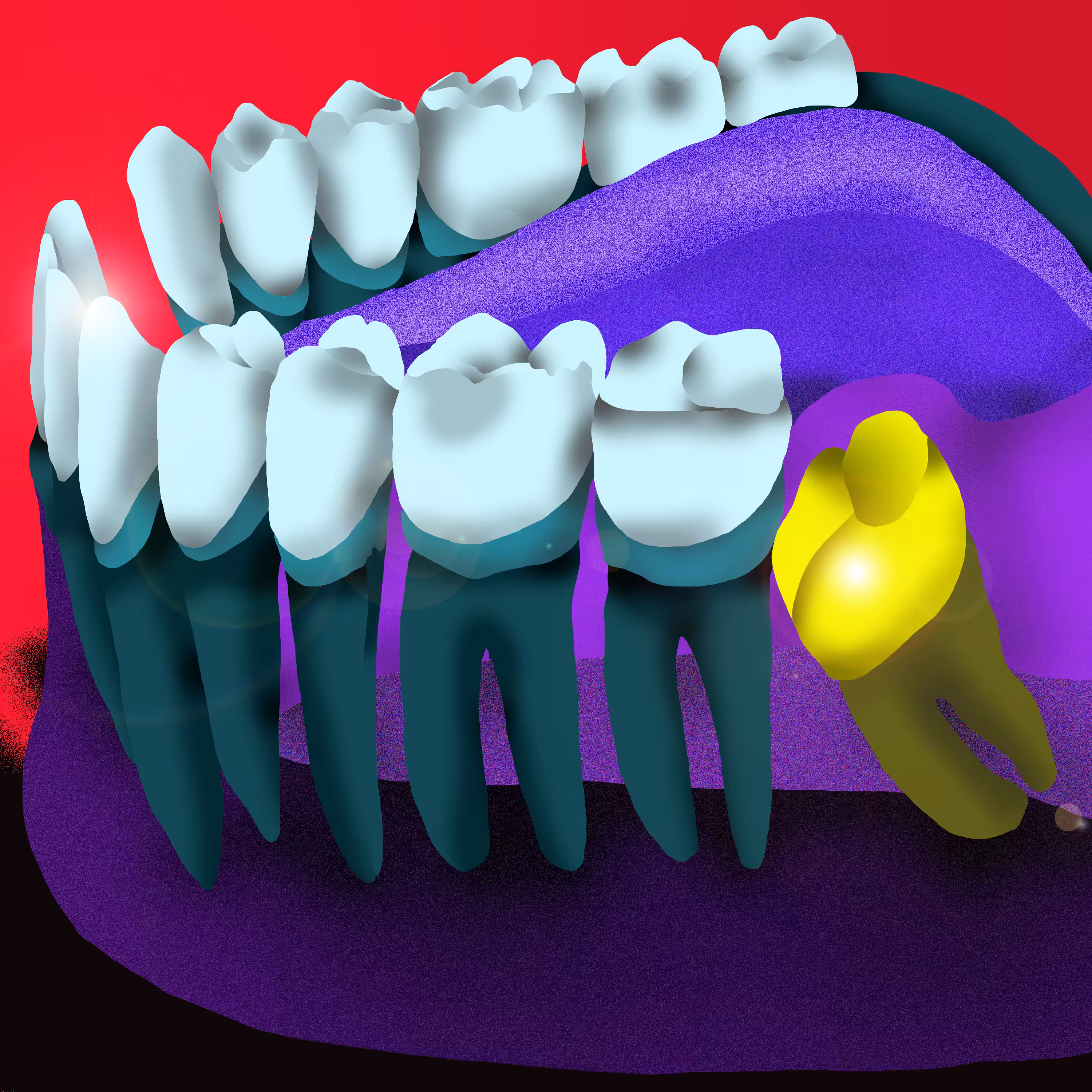Pieza Dental 19