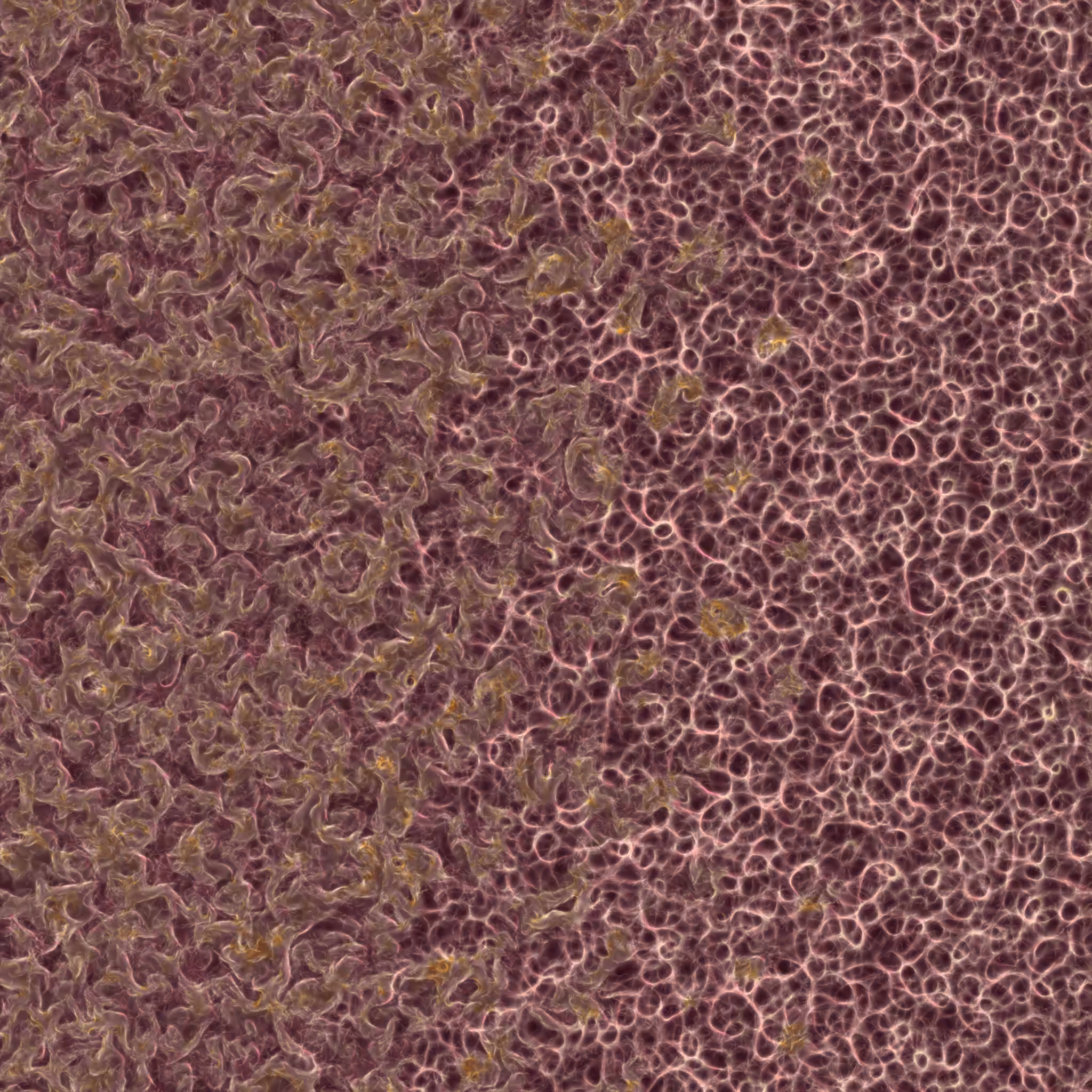 saprophyte #37