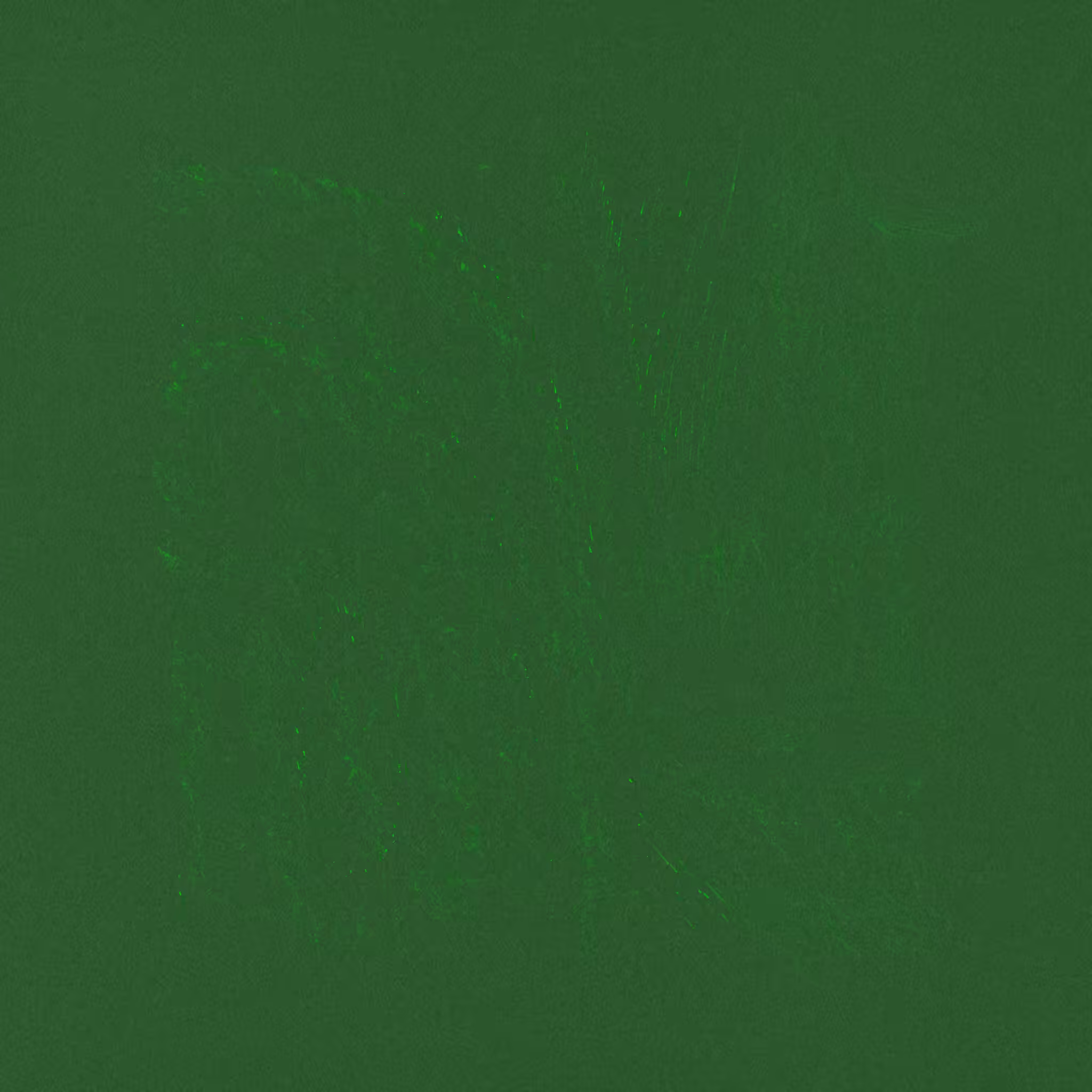 ANOMALIE #25