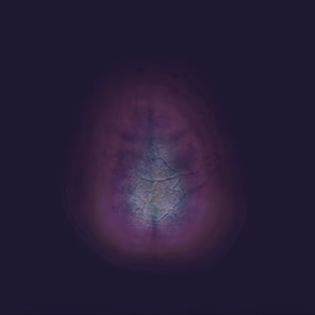 Diagnostics #1