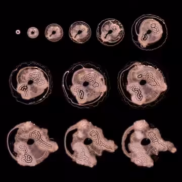 Embryogenesis #95
