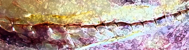 •	“A Beautiful Scar (Retold)”