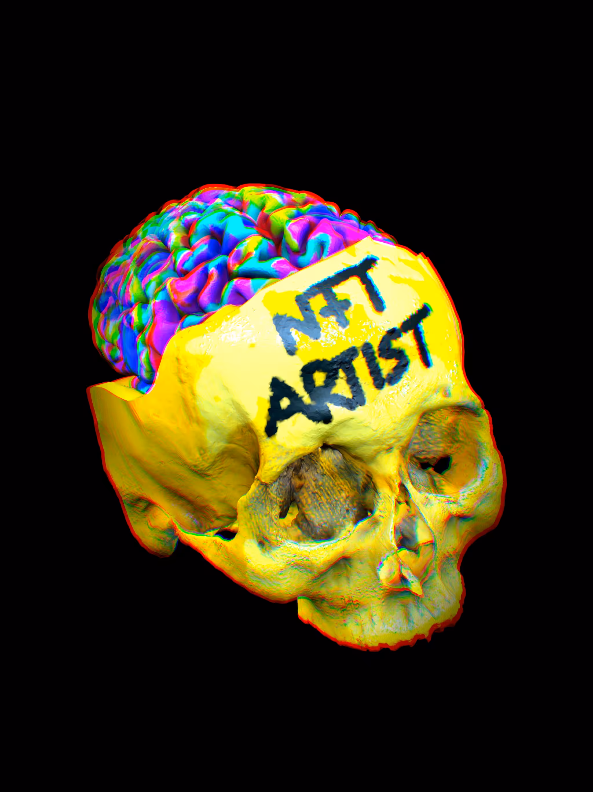 NFT Brain