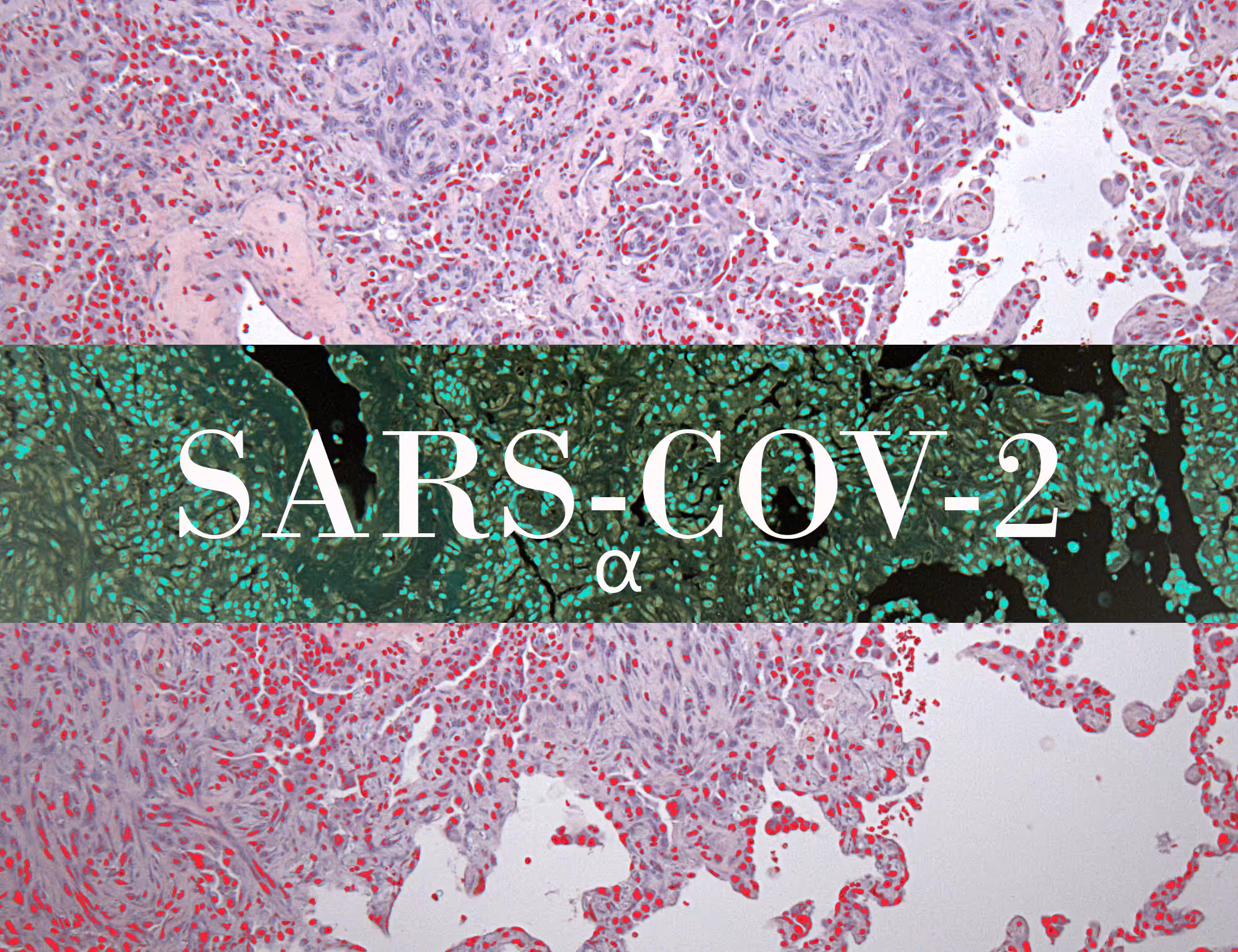 SARS-COV-2α