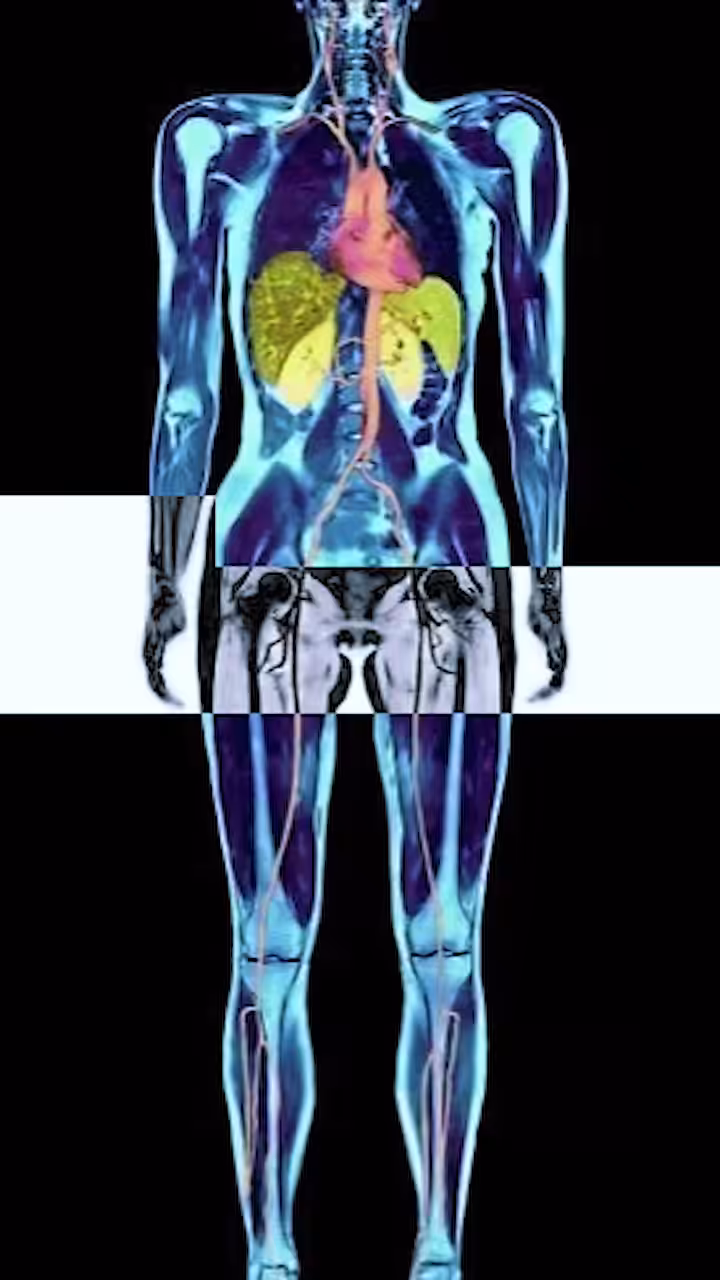 The Bionic Woman