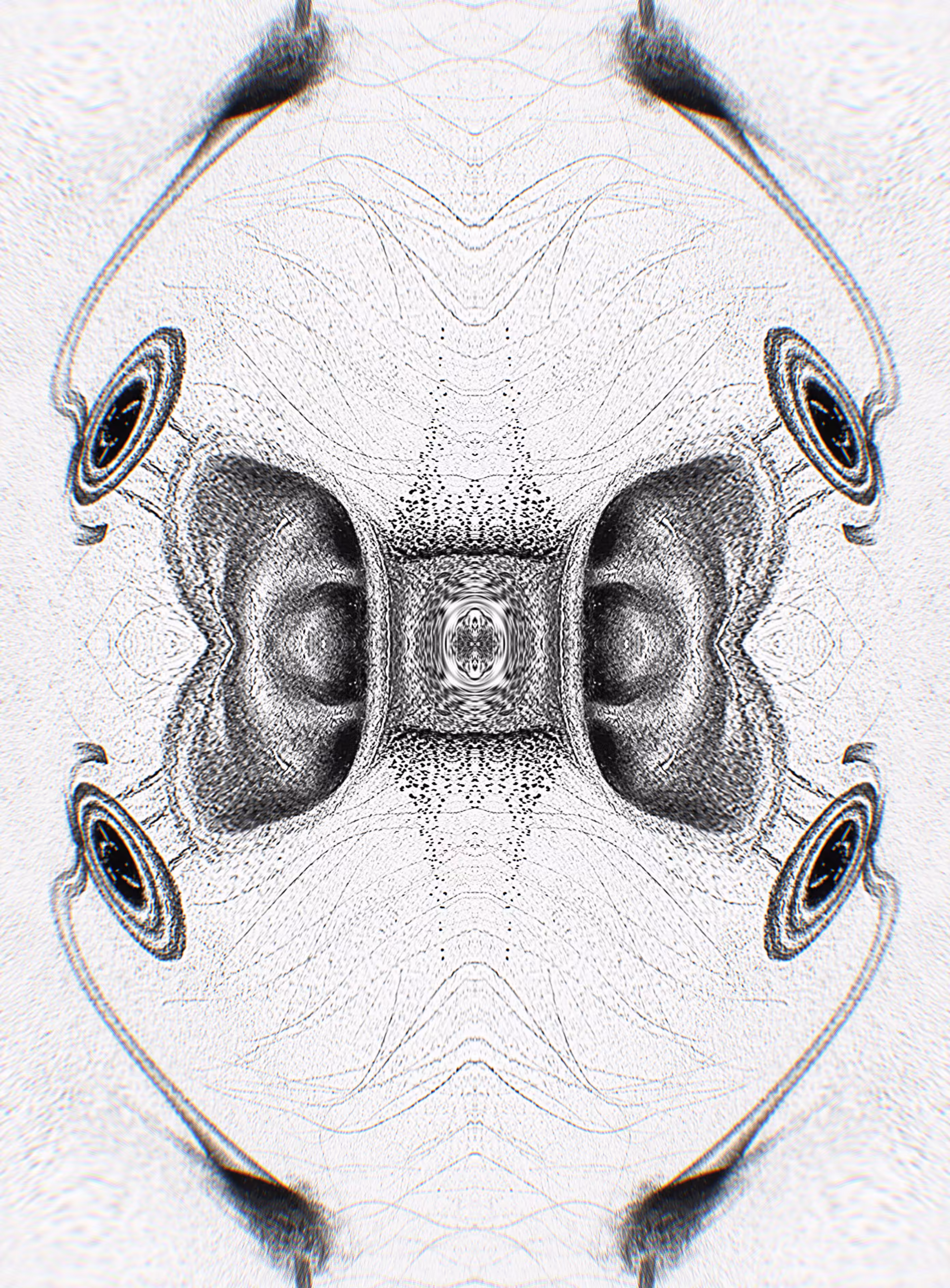 Pulsatile Tinnitus (Hypnogogic Vision)