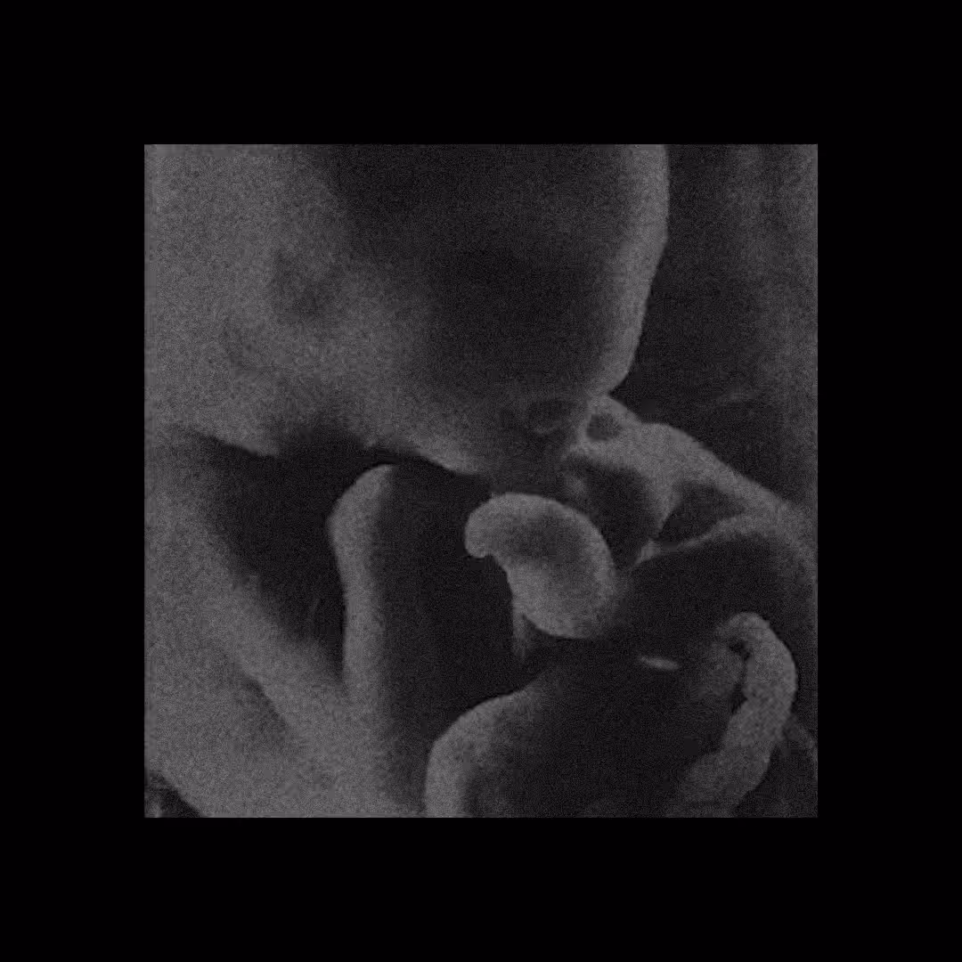 Embryo