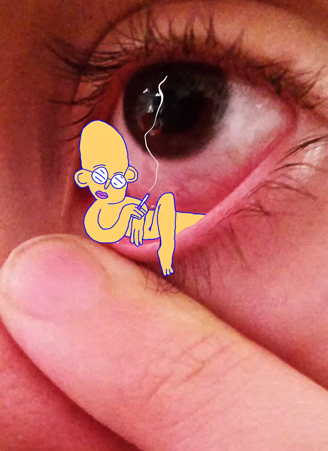 Eyedweller