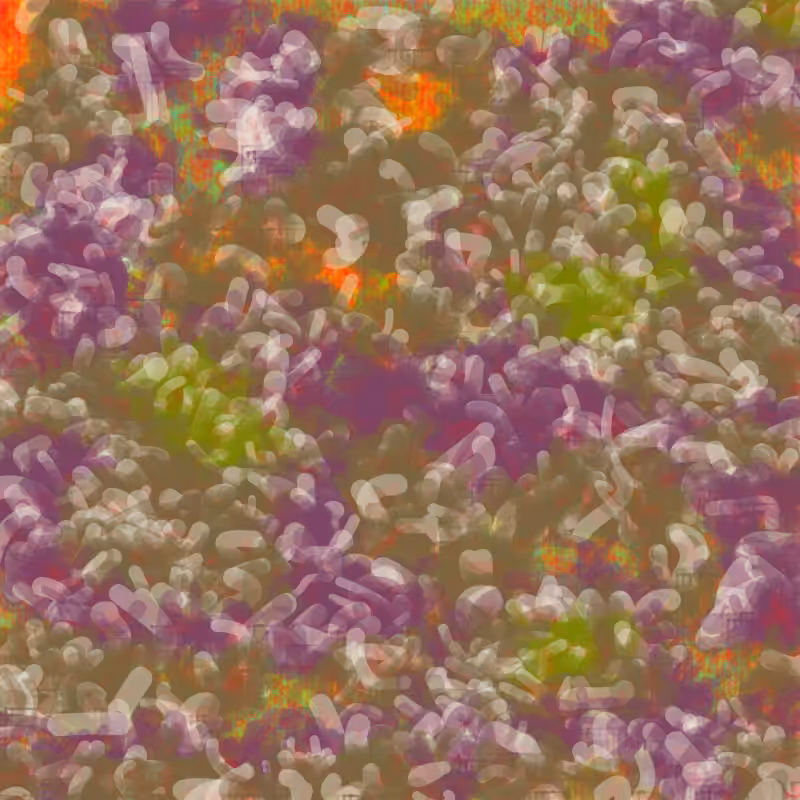 Petri 1500 #987