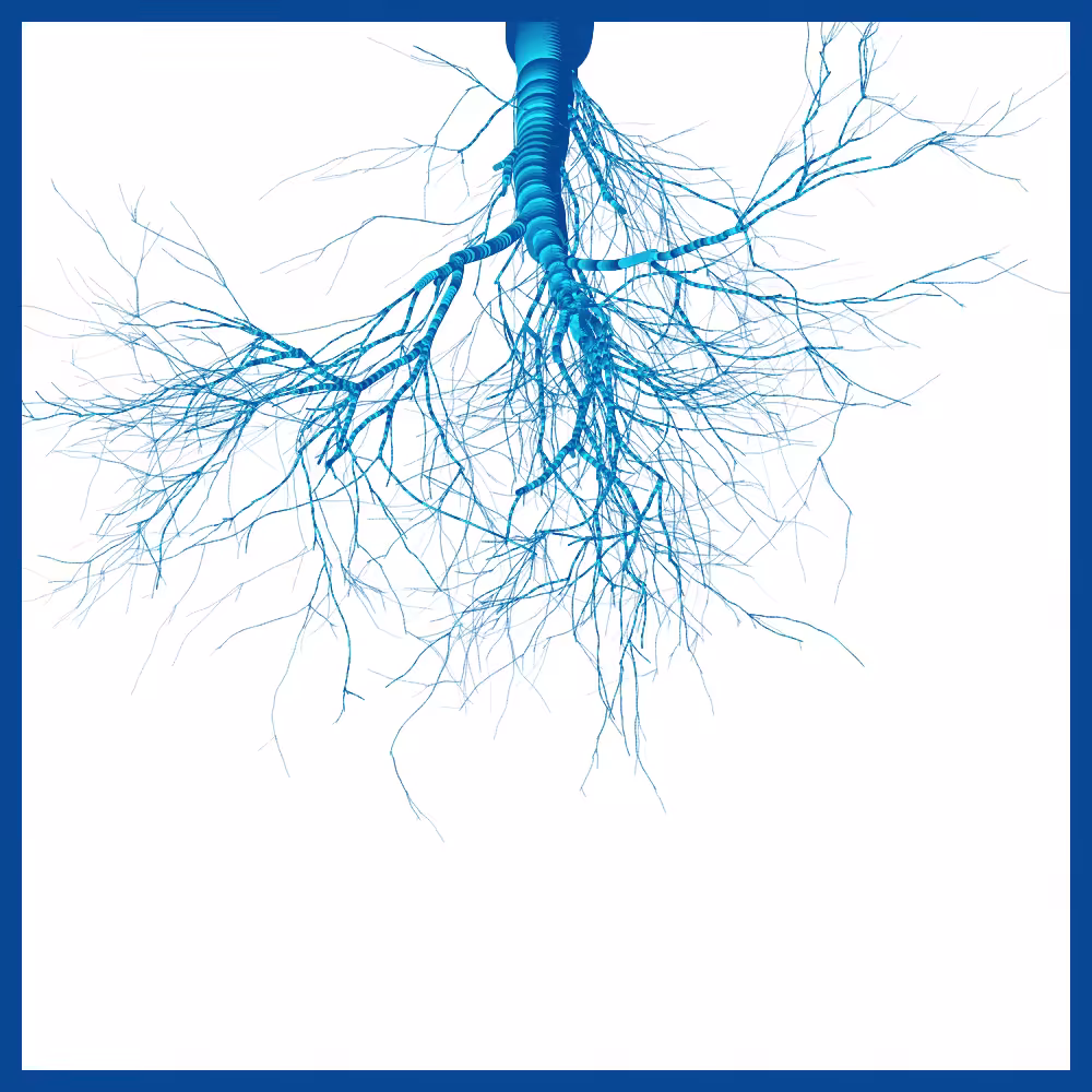 Arbres suspendus #174