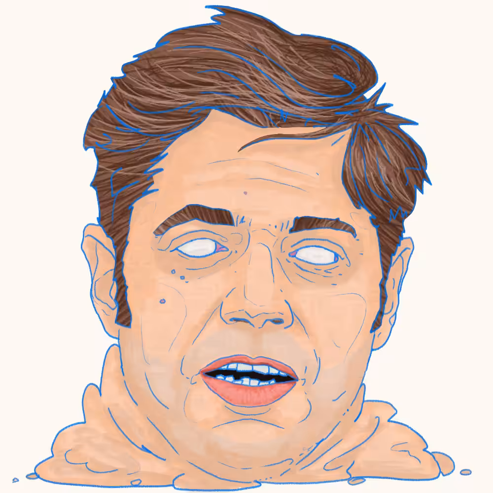 La cabeza muerta de Axel