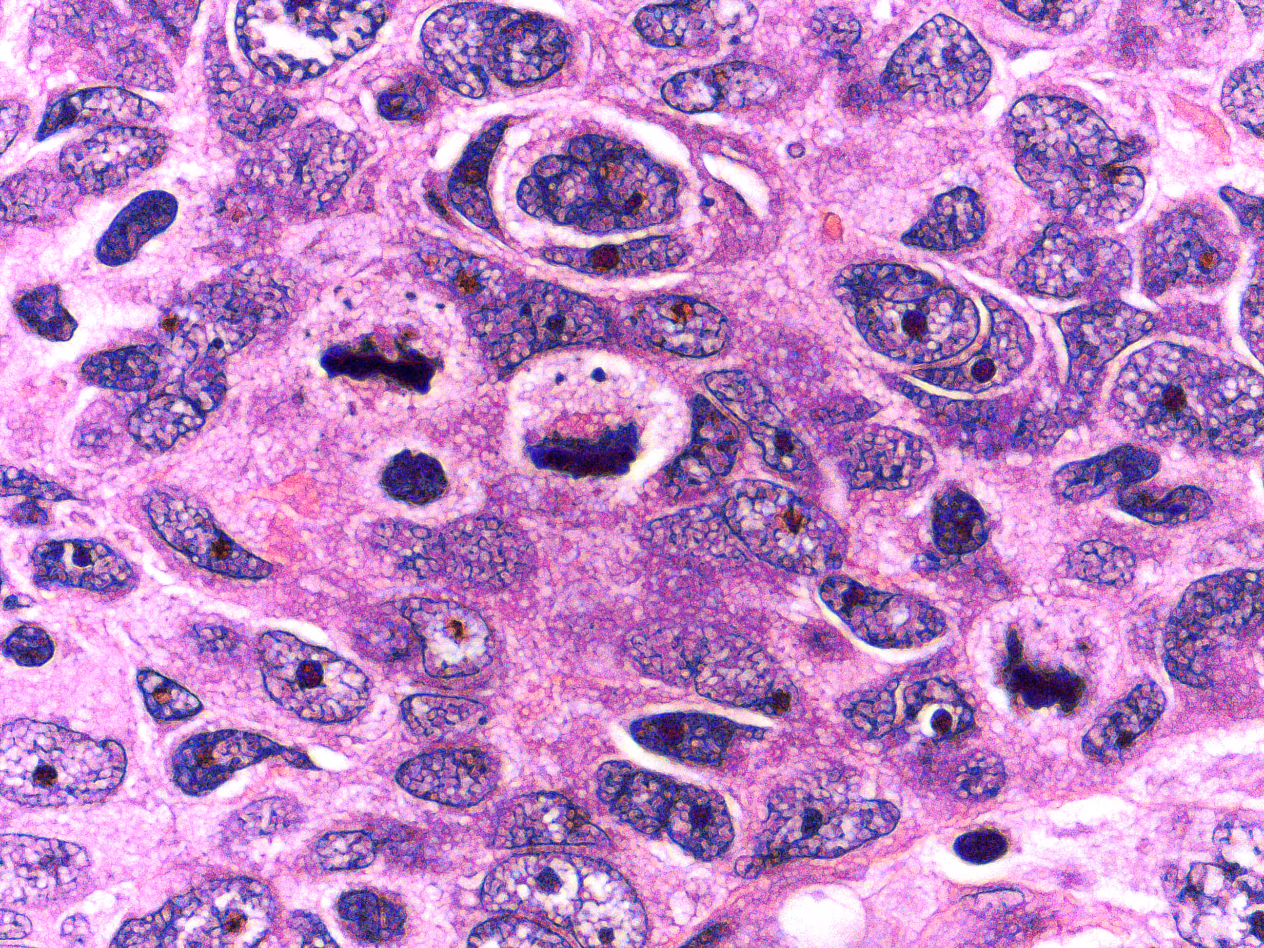 SARS-COV-2: INSIDIOMA