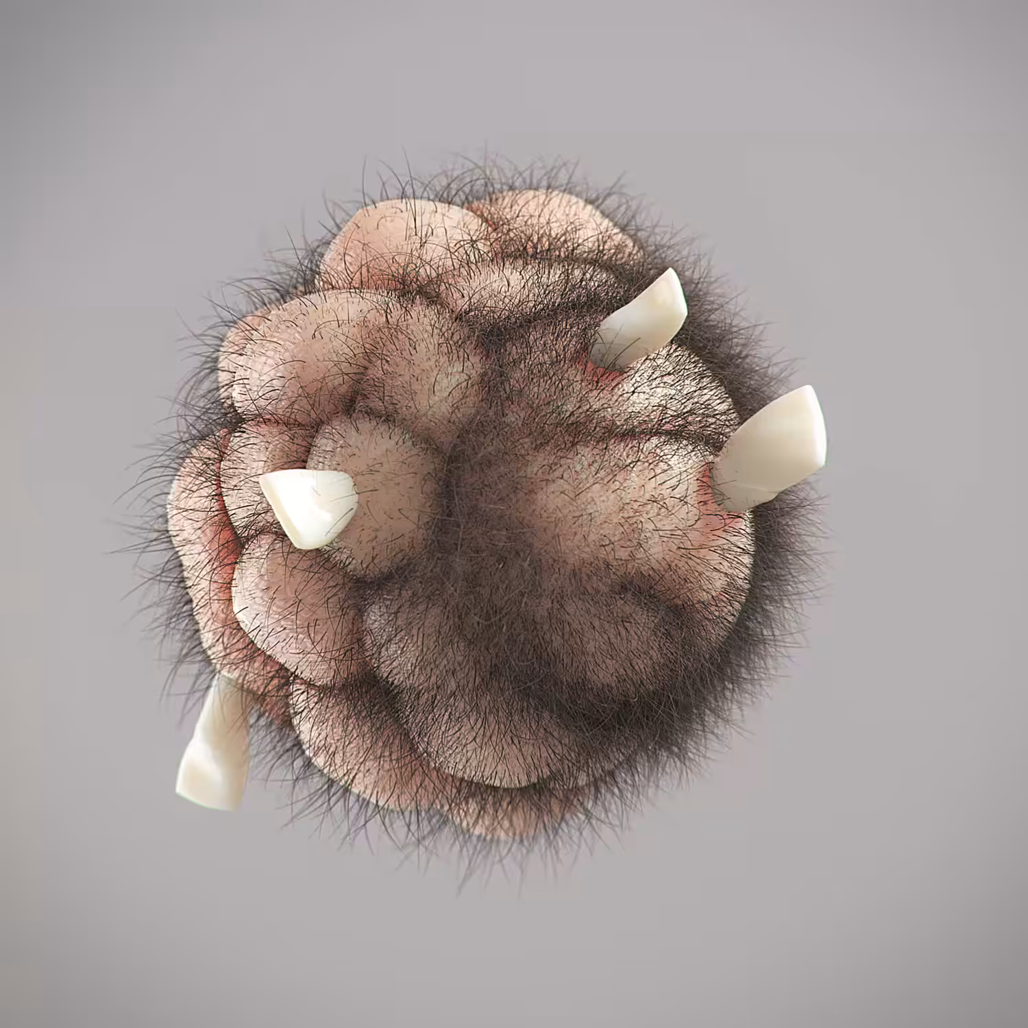 Dermoid
