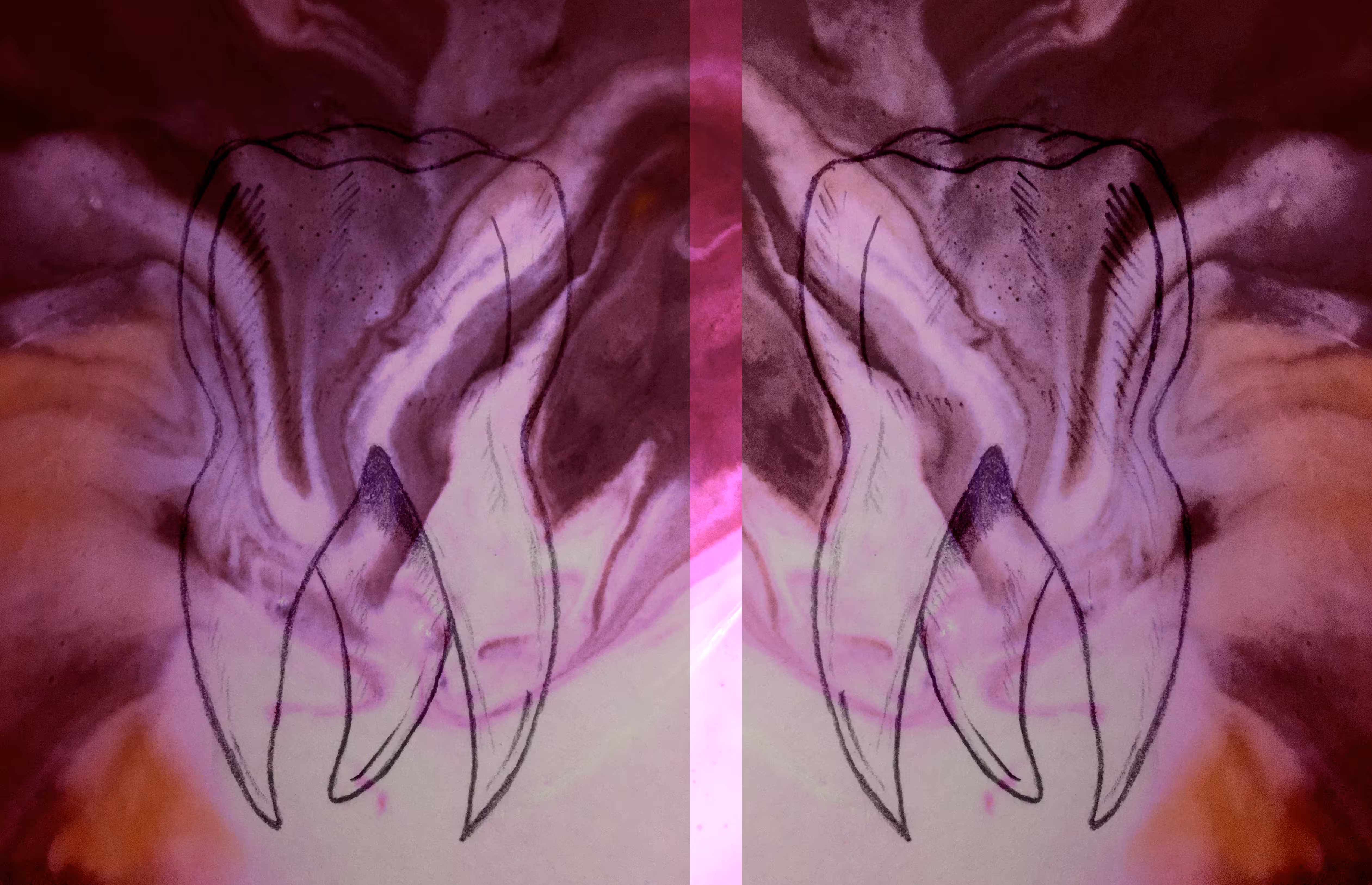 Tooth