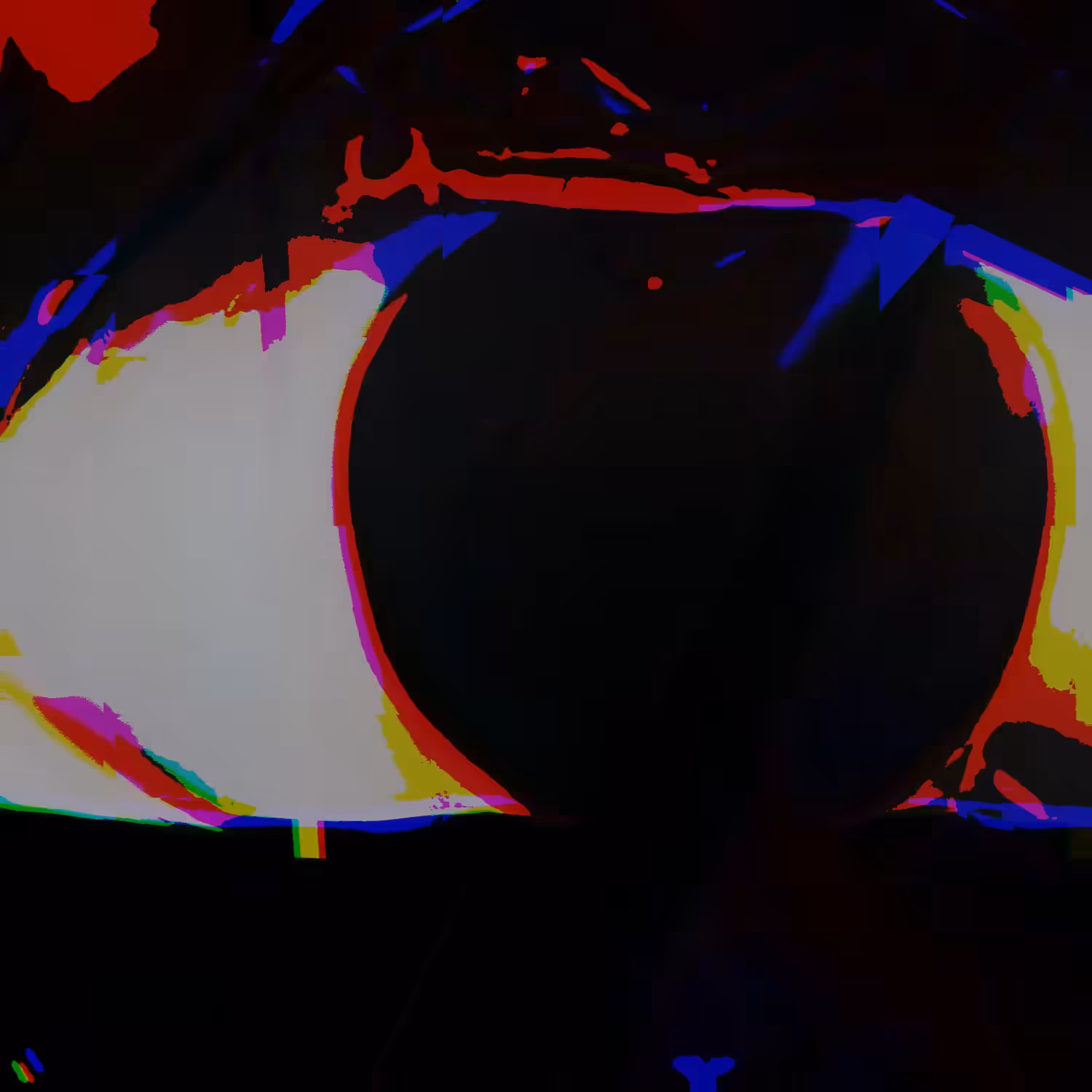 phils sus eye