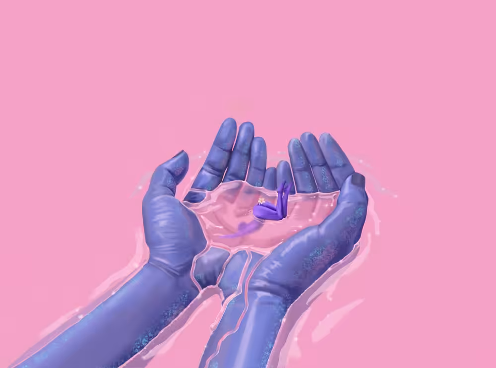 Forms of the universe #3