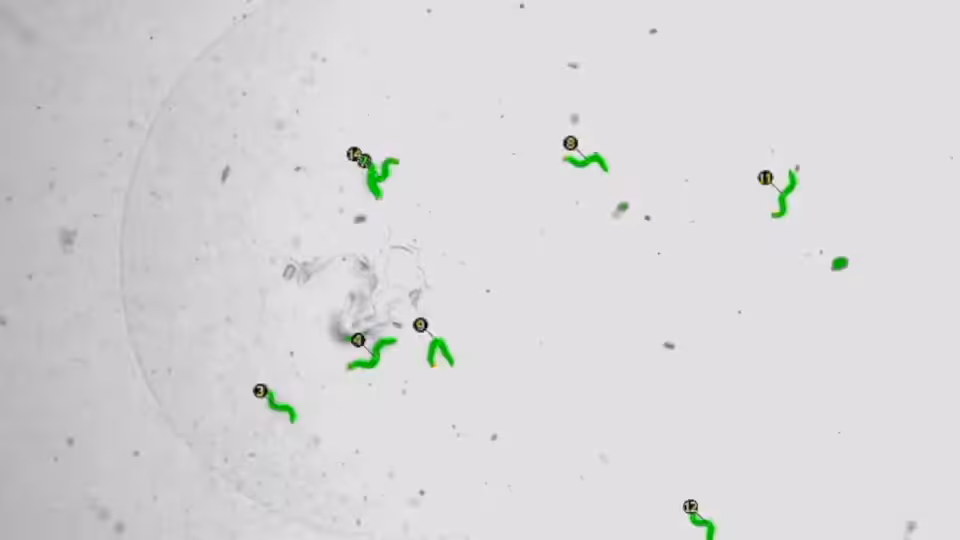 Worm Capture