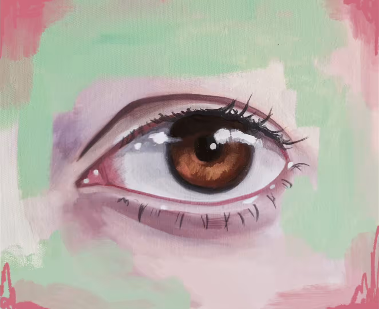 Midriasis