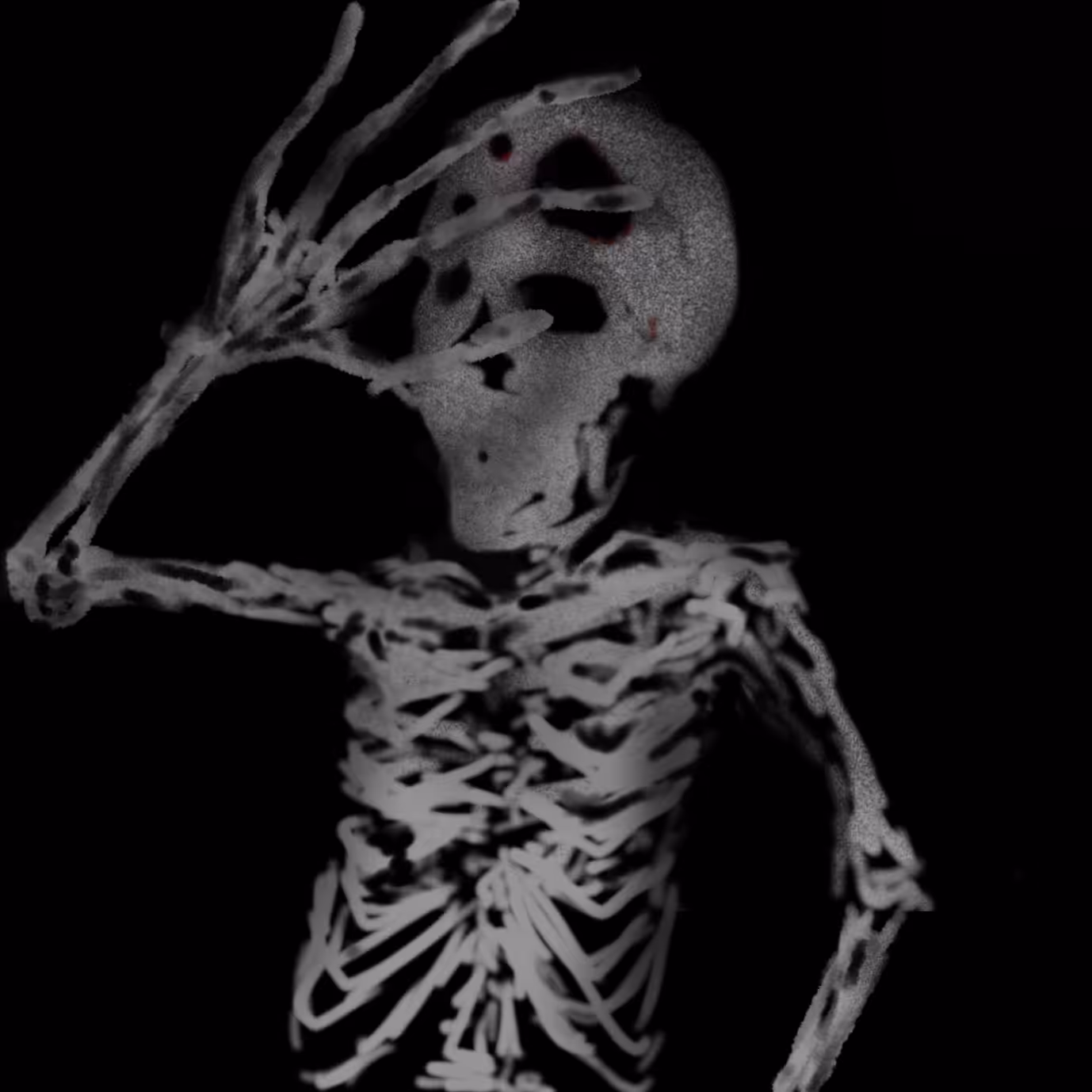 Skeleton