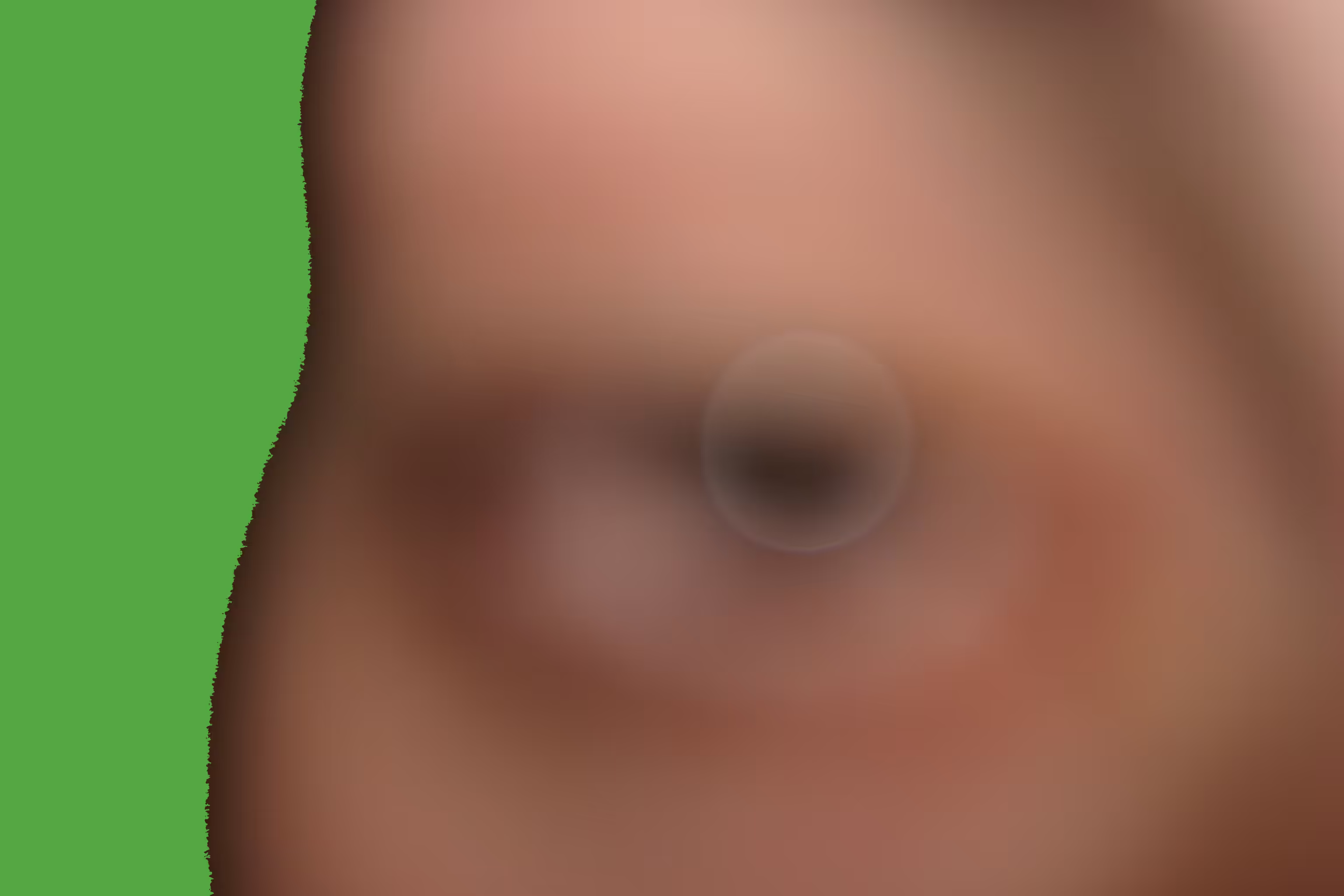 eye