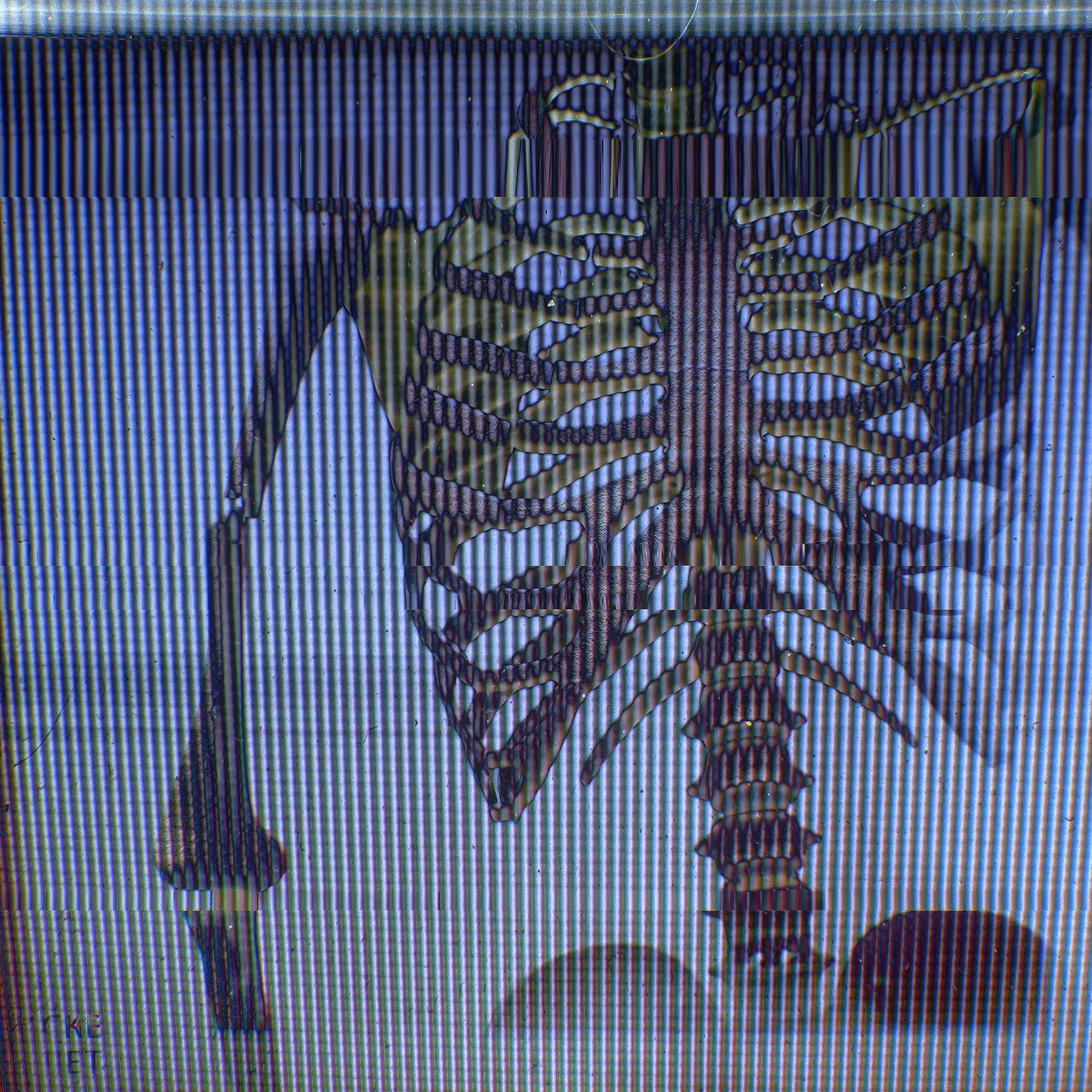 CARCASS