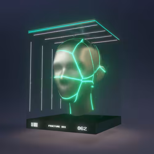 Fracture Boi: FRACTURE BOI - 062